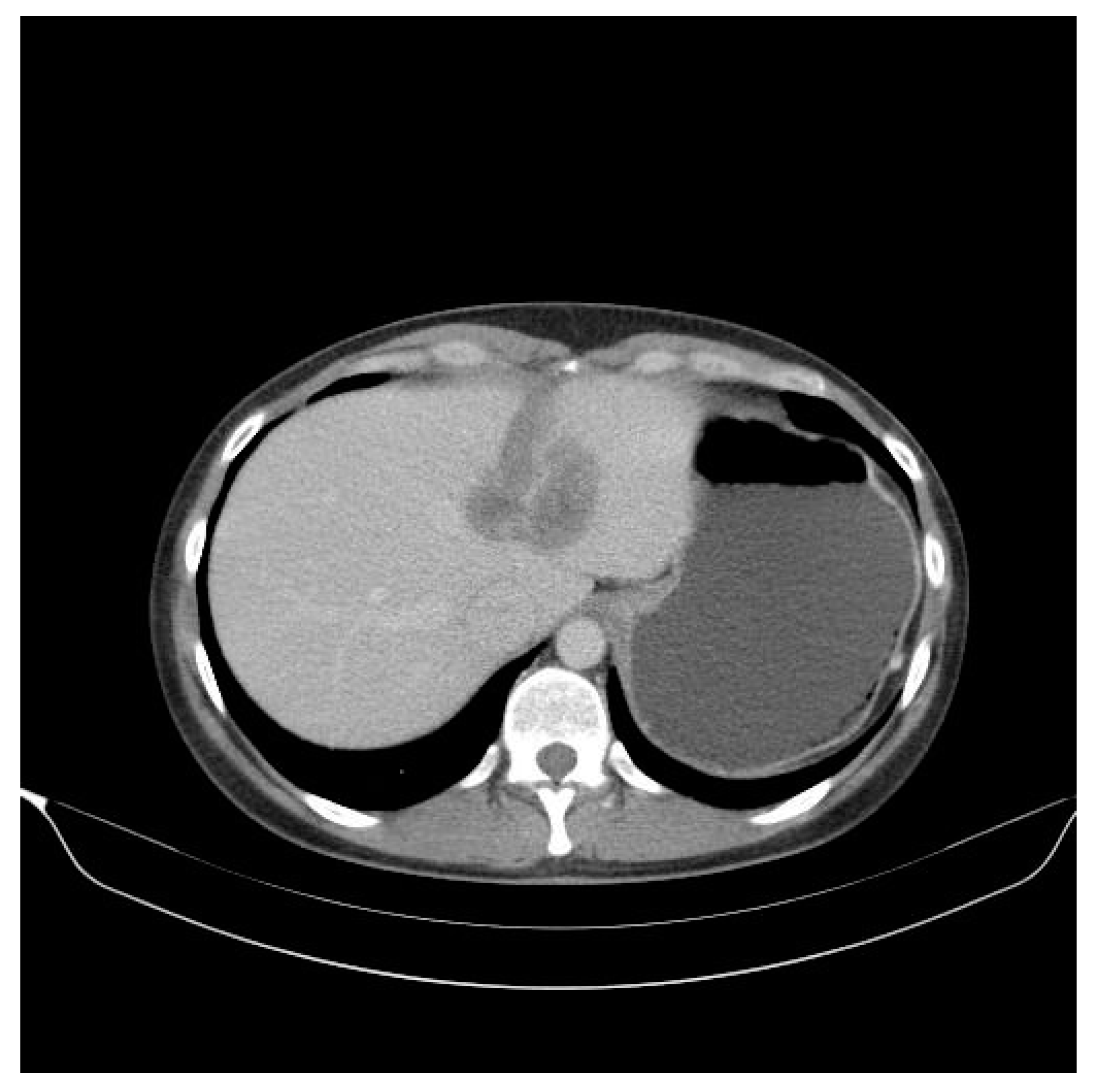 Curroncol 30 00364 g004