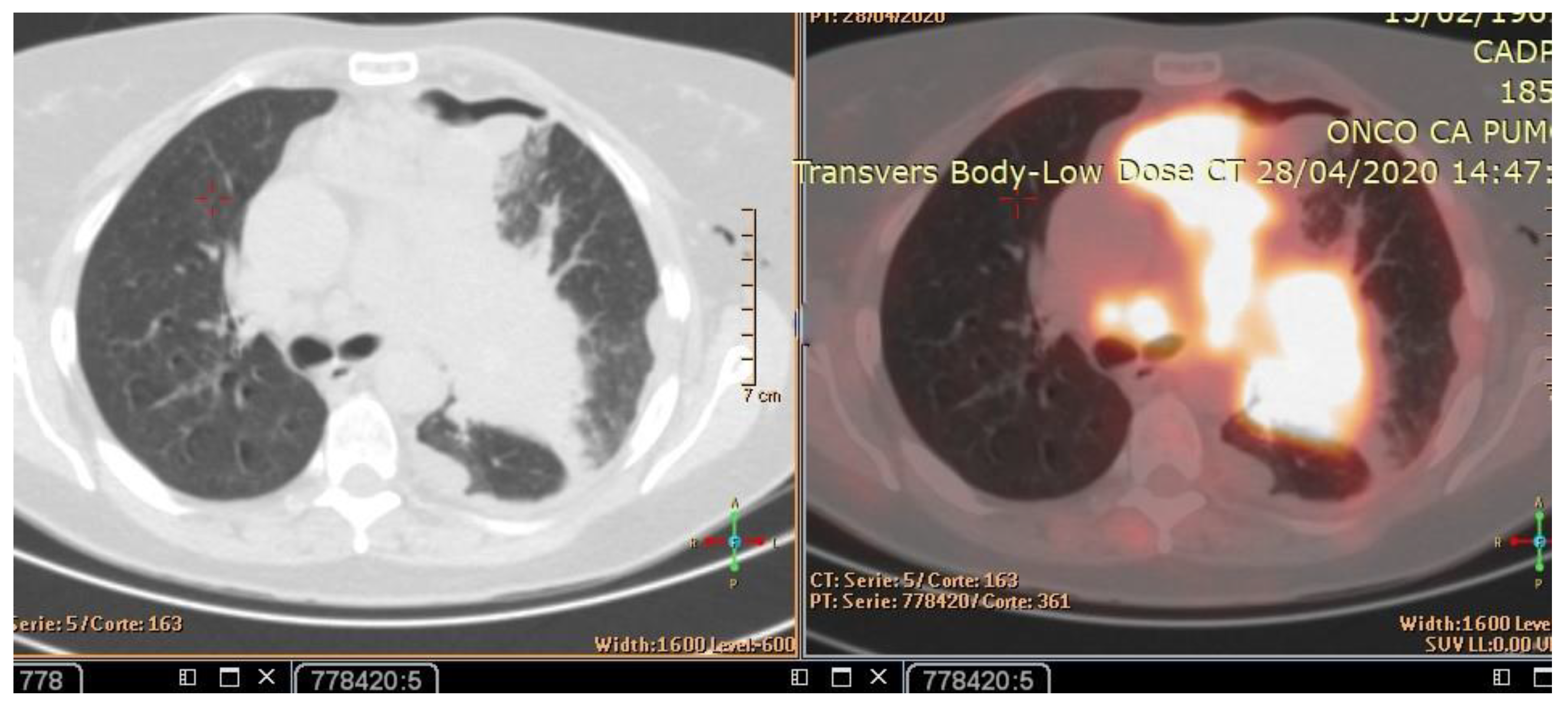 Curroncol 30 00365 g002