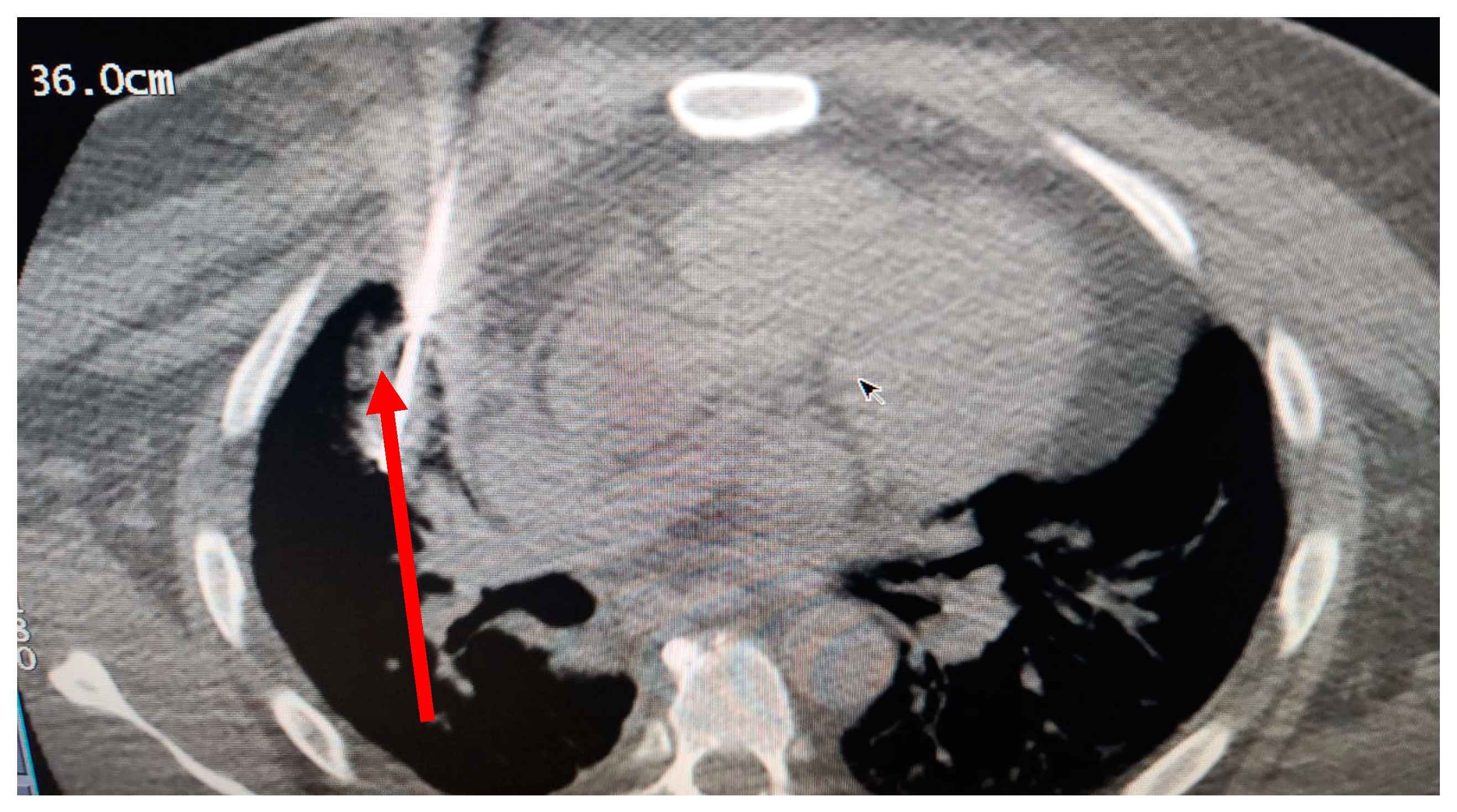Curroncol 30 00365 g005