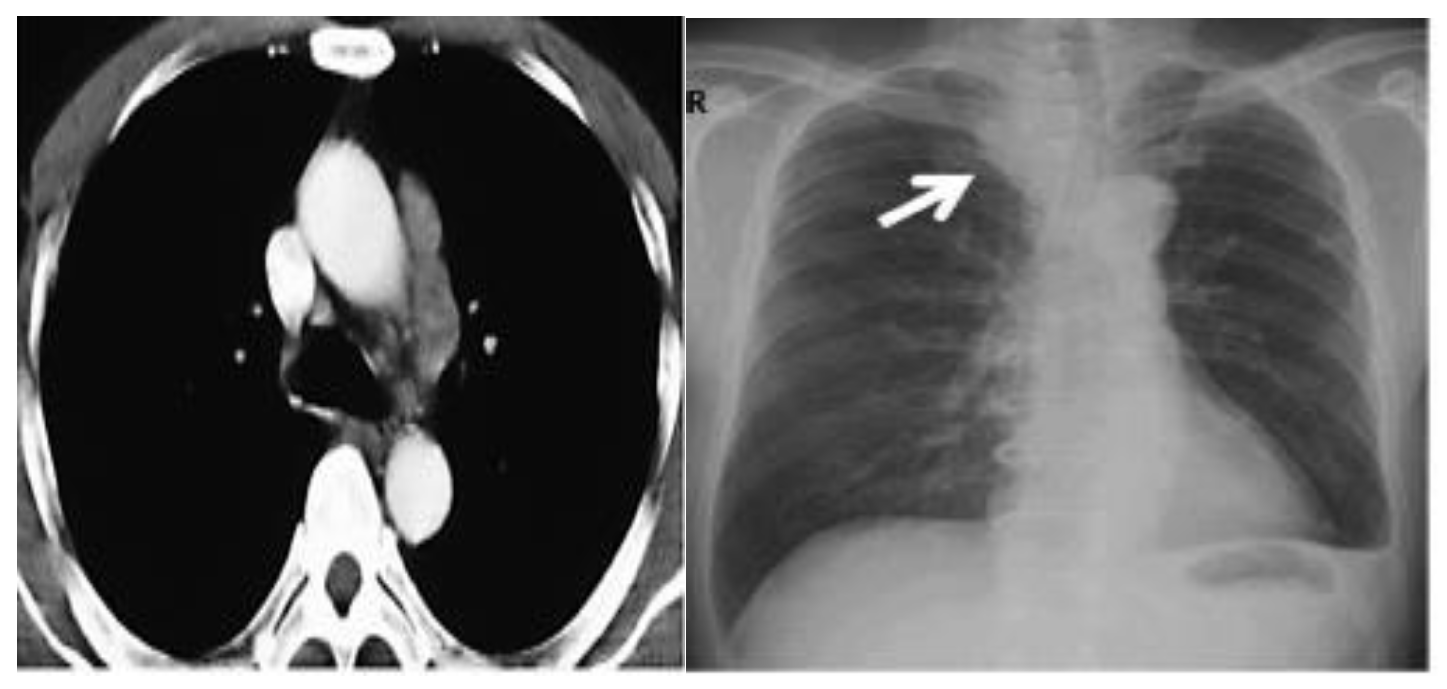 Curroncol 30 00365 g006