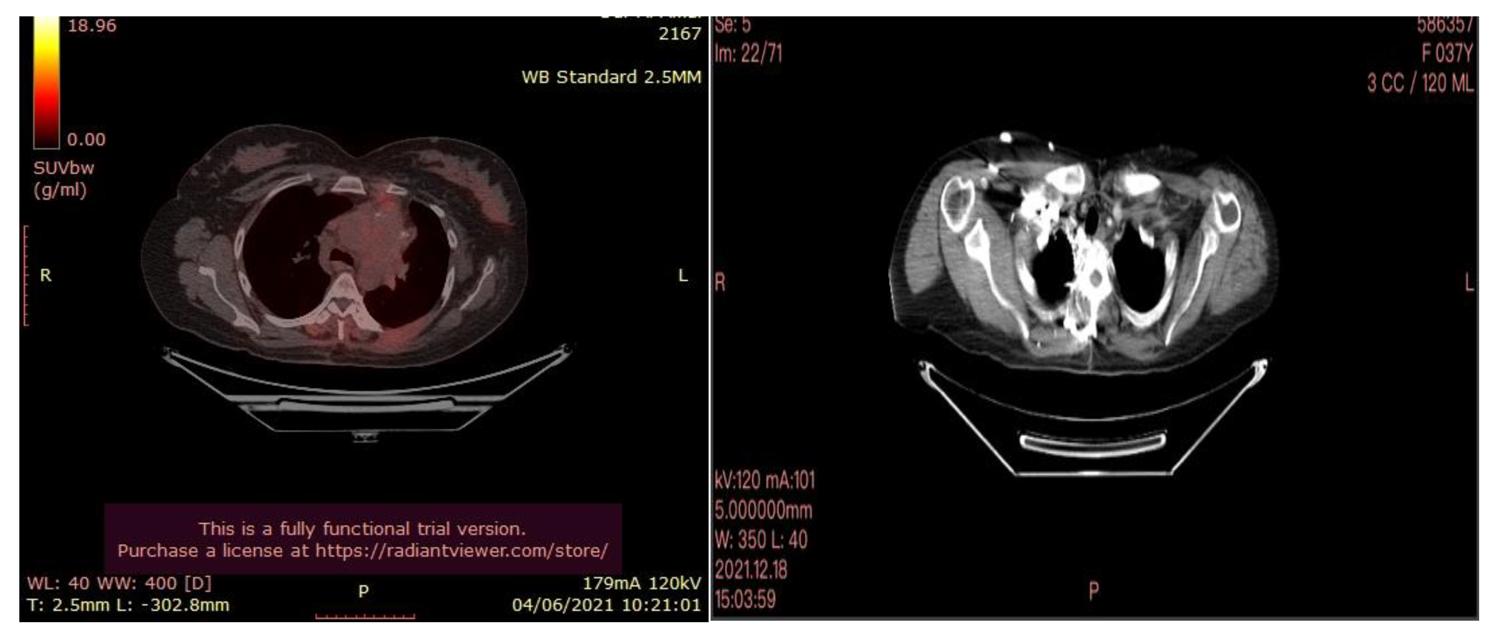 Curroncol 30 00365 g007
