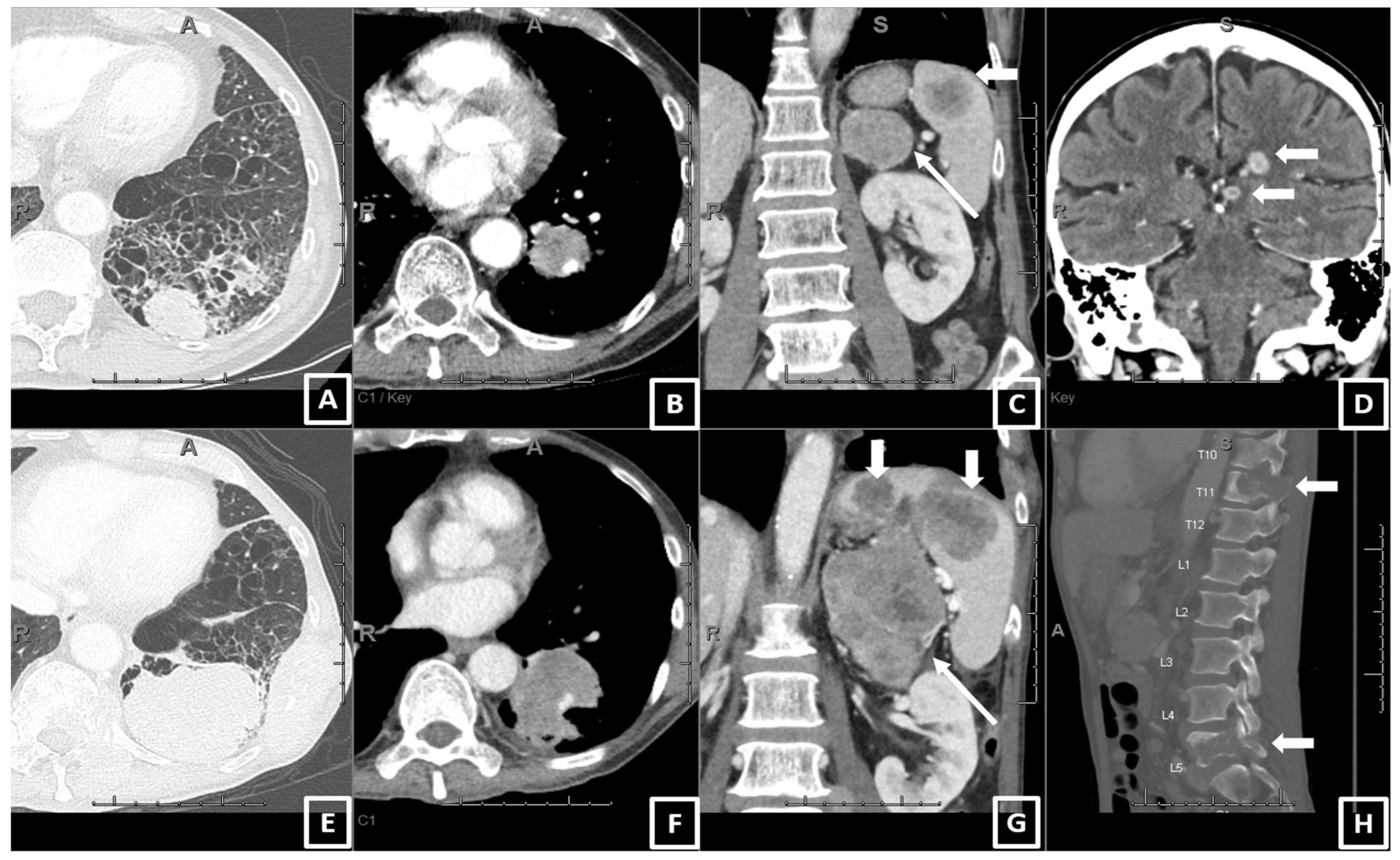 Curroncol 30 00419 g002 Curroncol 30 00419 g002