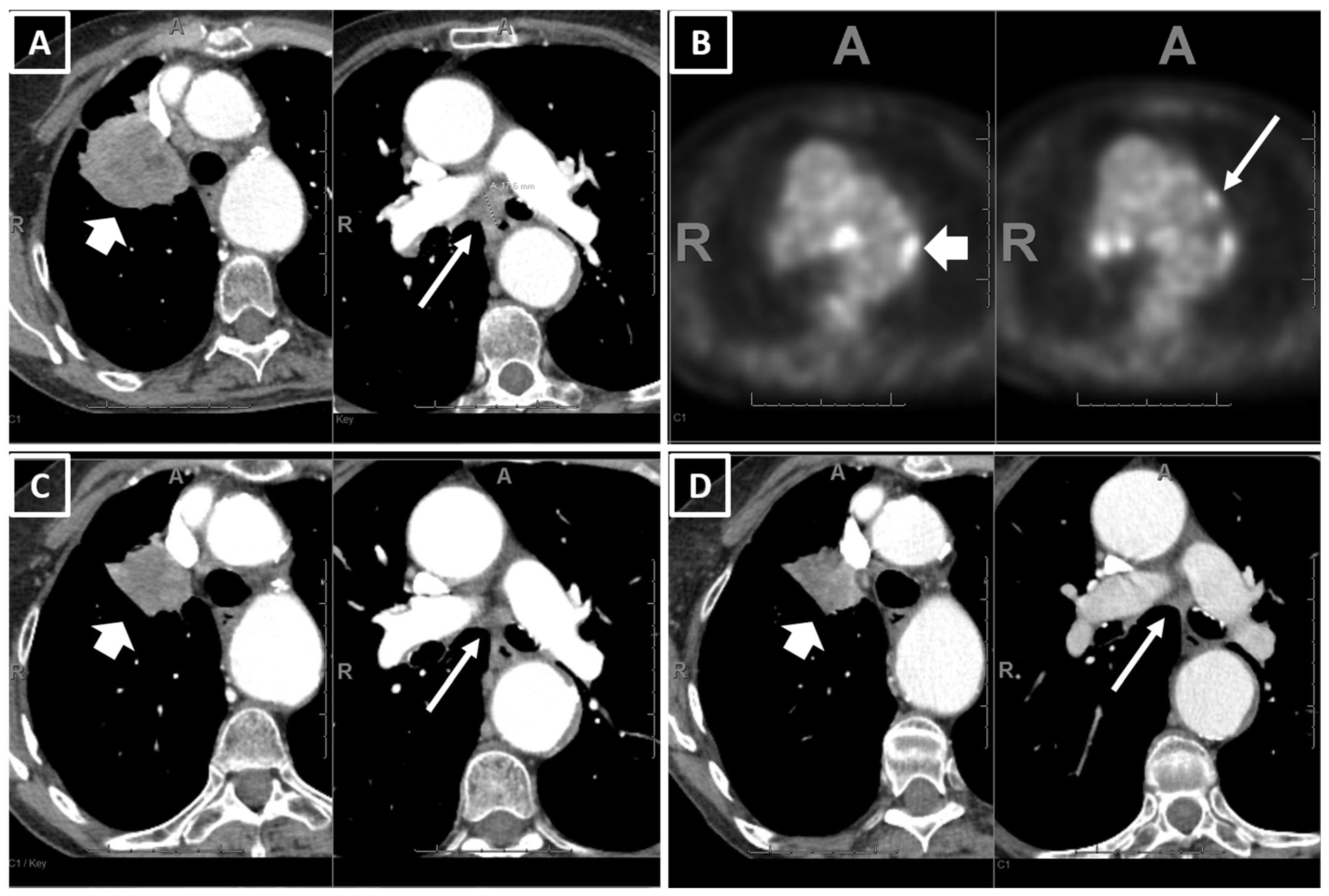 Curroncol 30 00419 g003 Curroncol 30 00419 g003