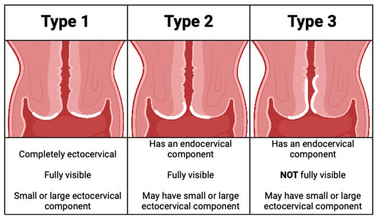 Vaginal Bleeding - Gynecology and Obstetrics - Merck Manuals