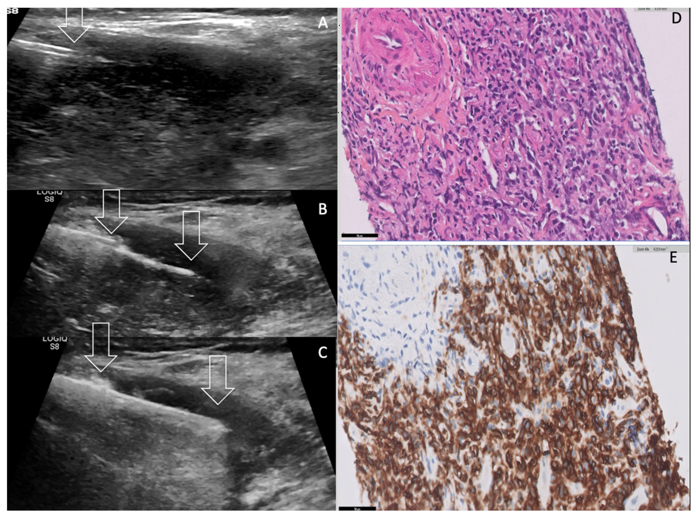 Curroncol 30 00435 g002