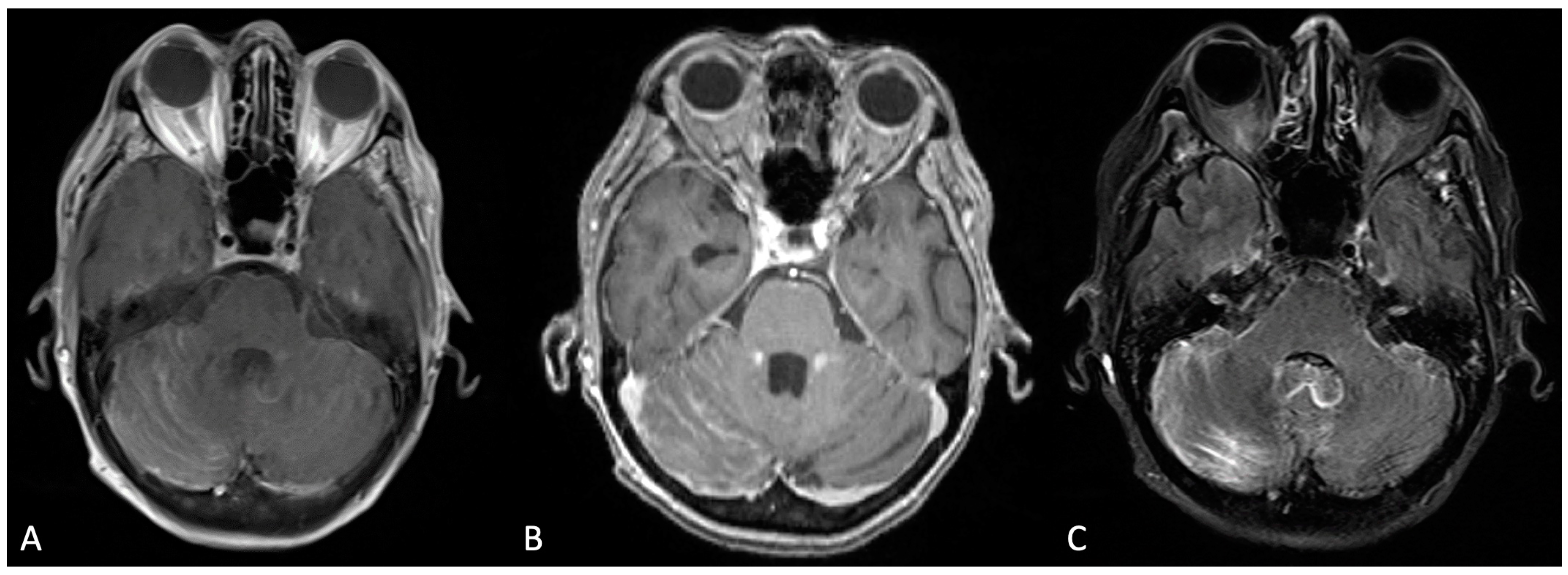 Curroncol 30 00442 g001 Curroncol 30 00442 g001