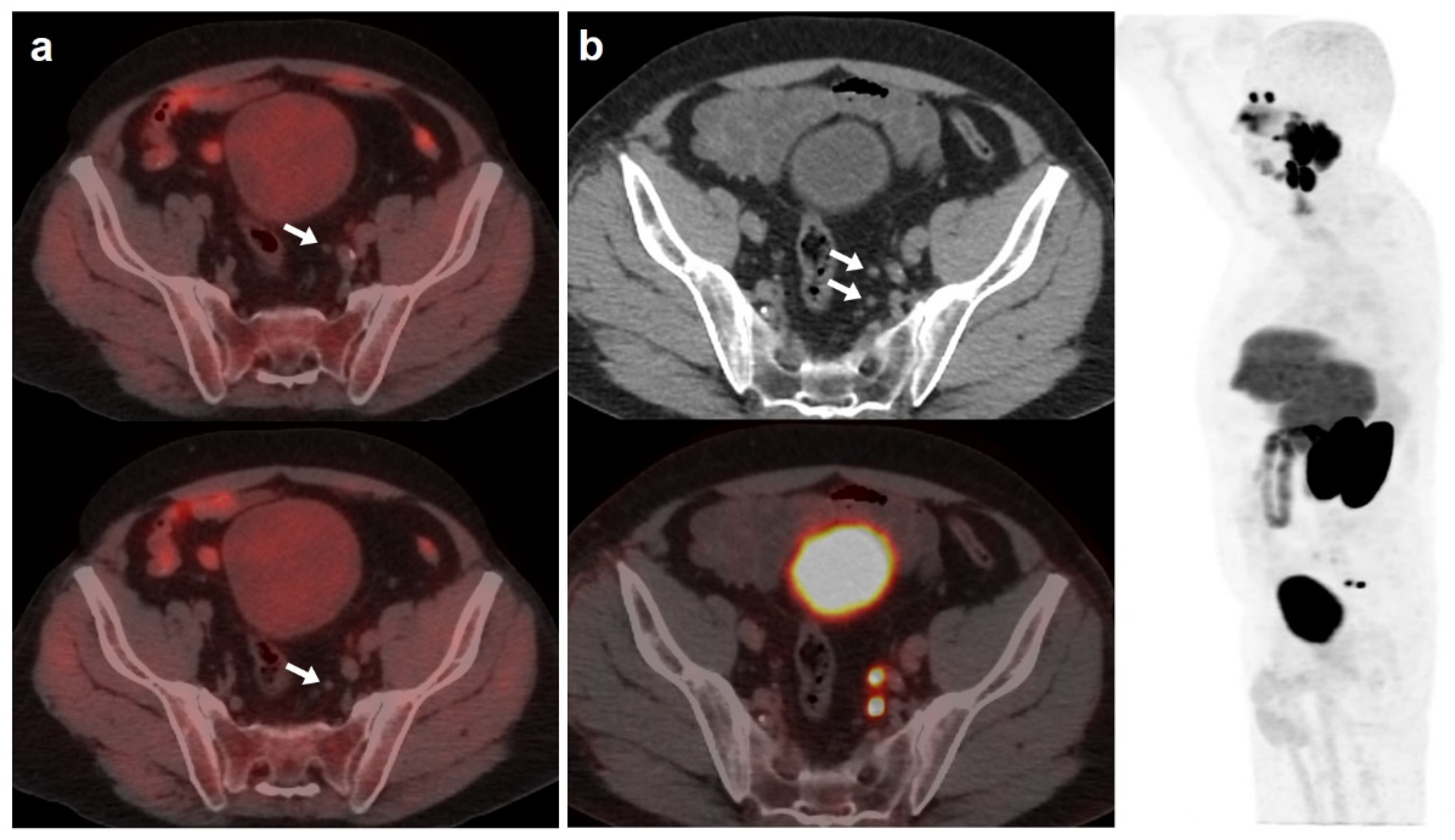 Curroncol 30 00464 g002 Curroncol 30 00464 g002