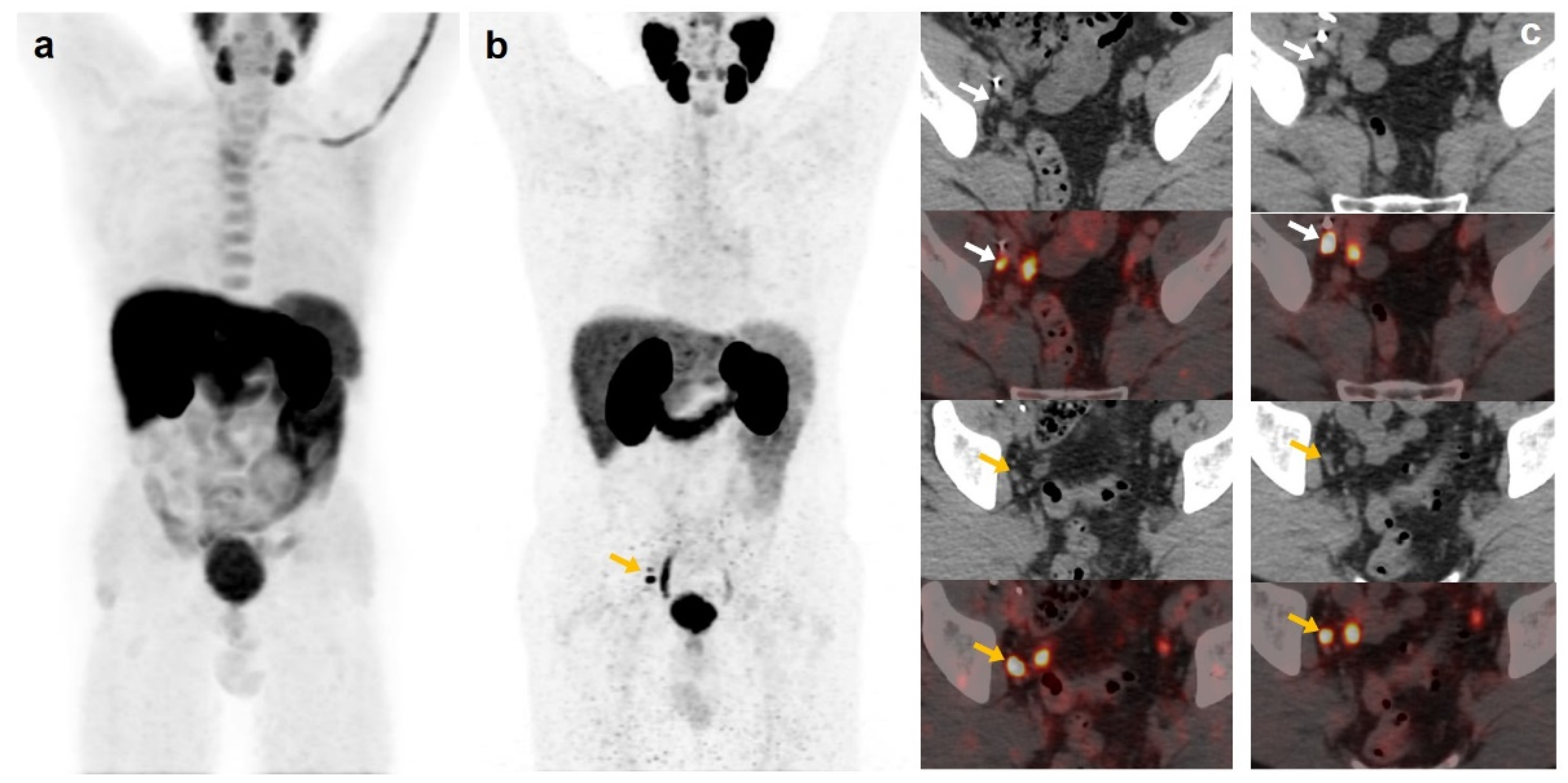 Curroncol 30 00464 g003 Curroncol 30 00464 g003