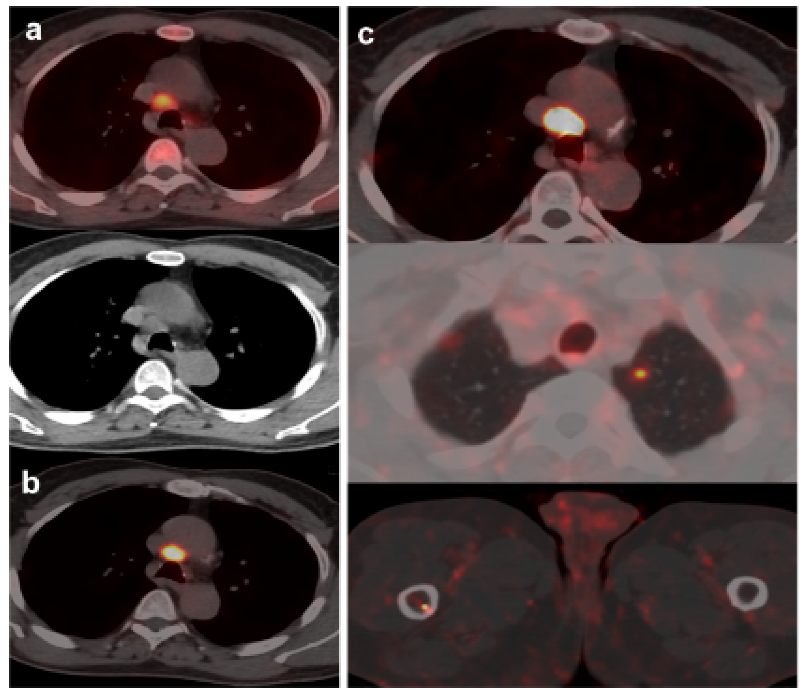 Curroncol 30 00464 g004 Curroncol 30 00464 g004