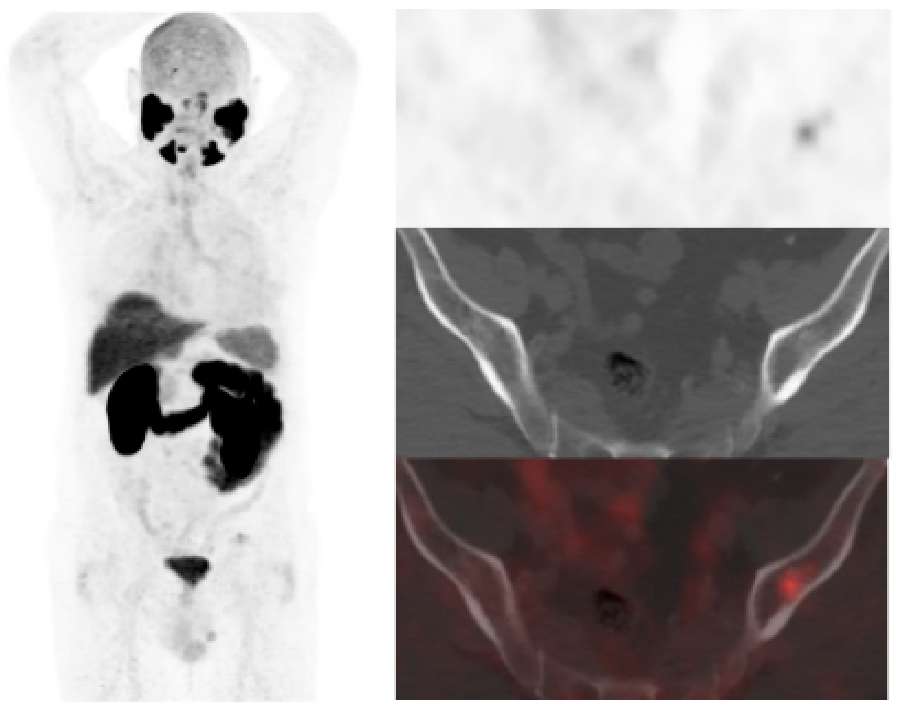 Curroncol 30 00464 g005 Curroncol 30 00464 g005