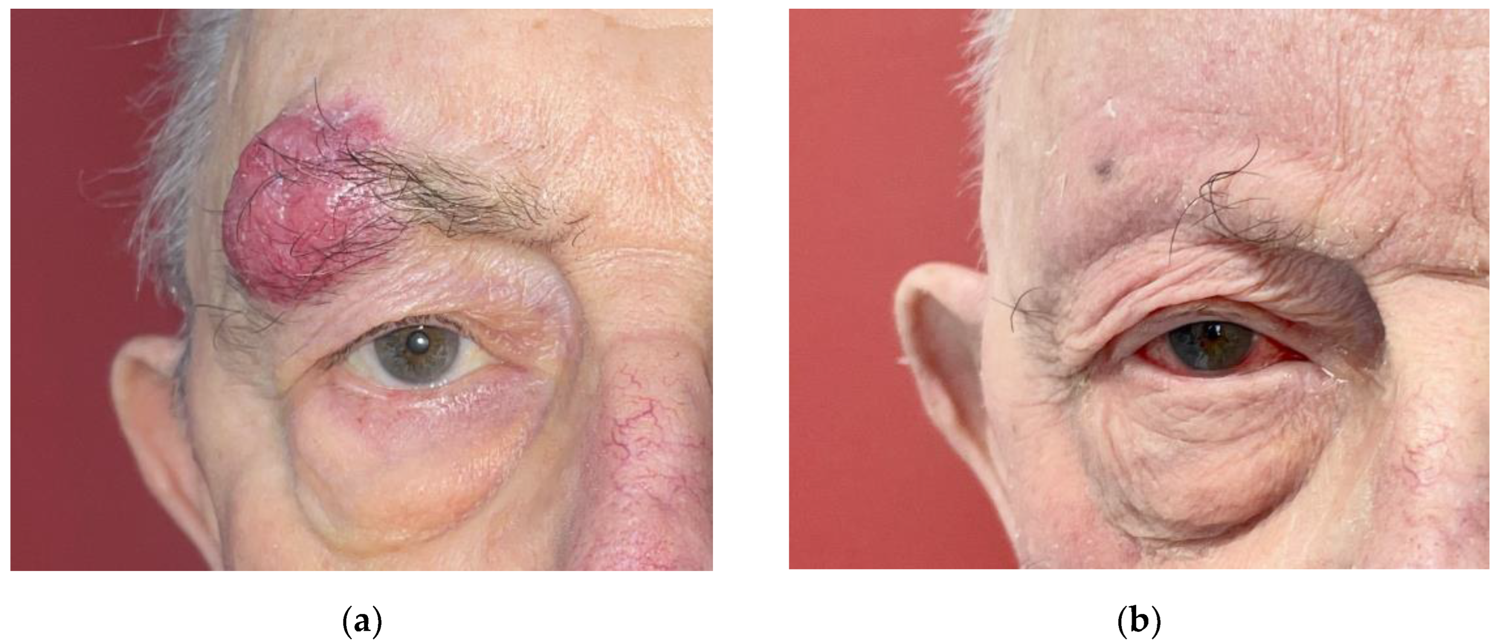 Curroncol 30 00468 g001