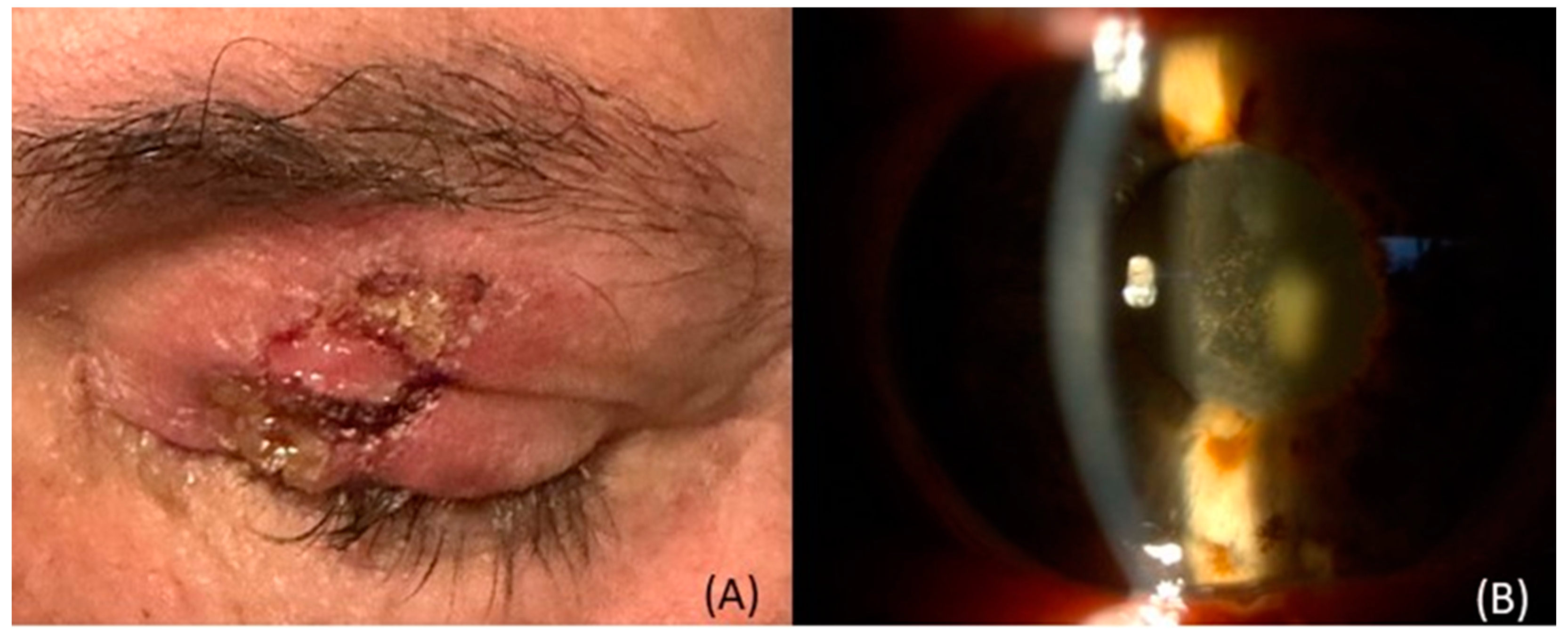 Curroncol 30 00470 g001 Curroncol 30 00470 g001
