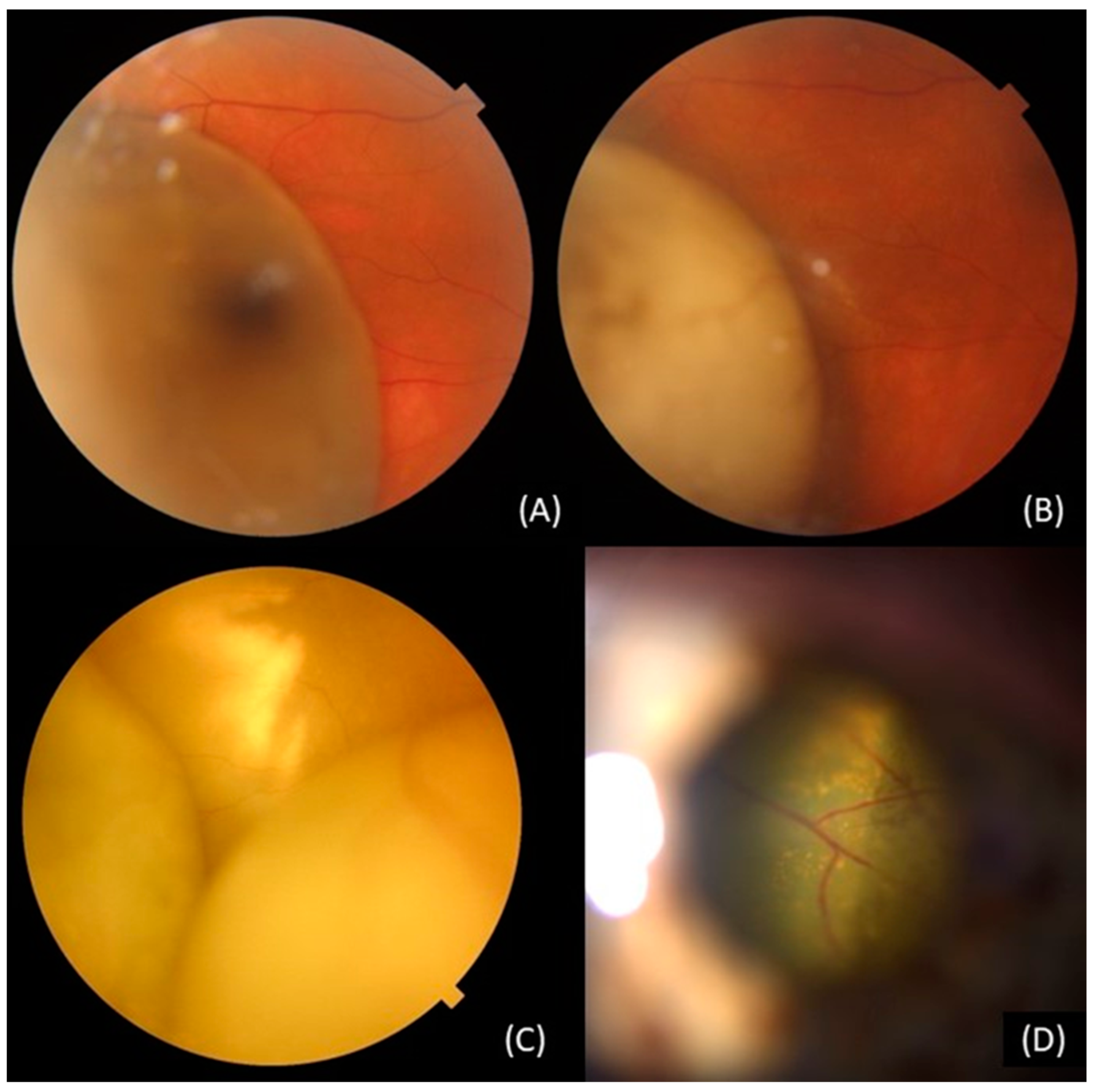 Curroncol 30 00470 g003 Curroncol 30 00470 g003