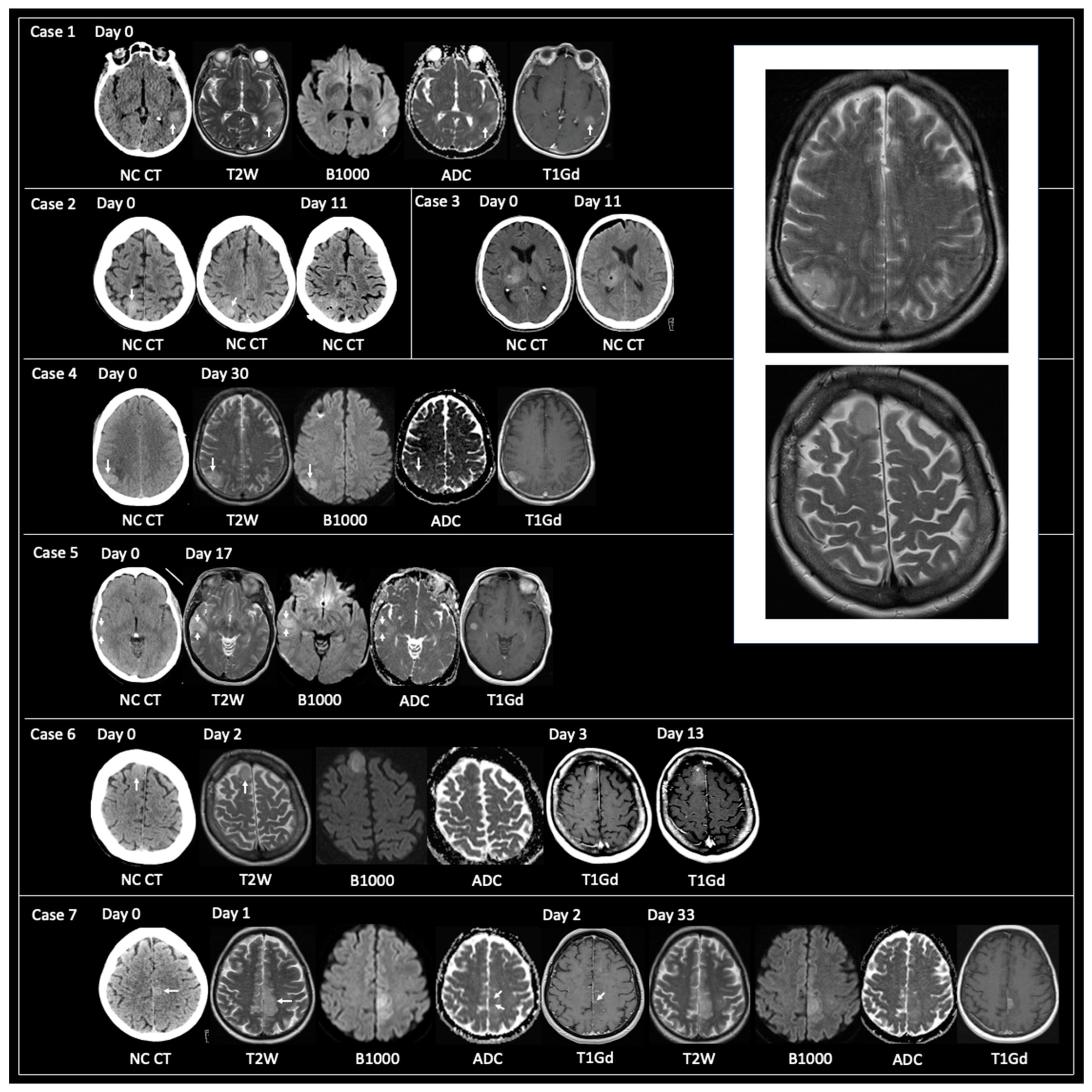 Curroncol 30 00490 g002 Curroncol 30 00490 g002