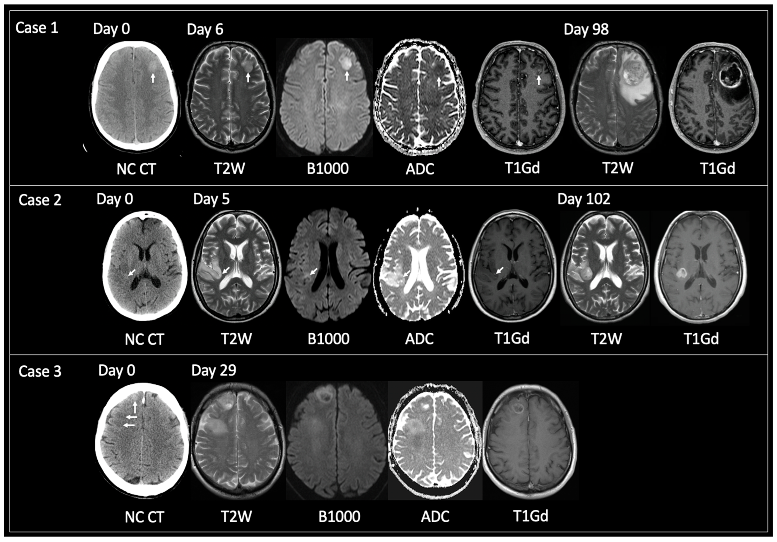 Curroncol 30 00490 g003 Curroncol 30 00490 g003
