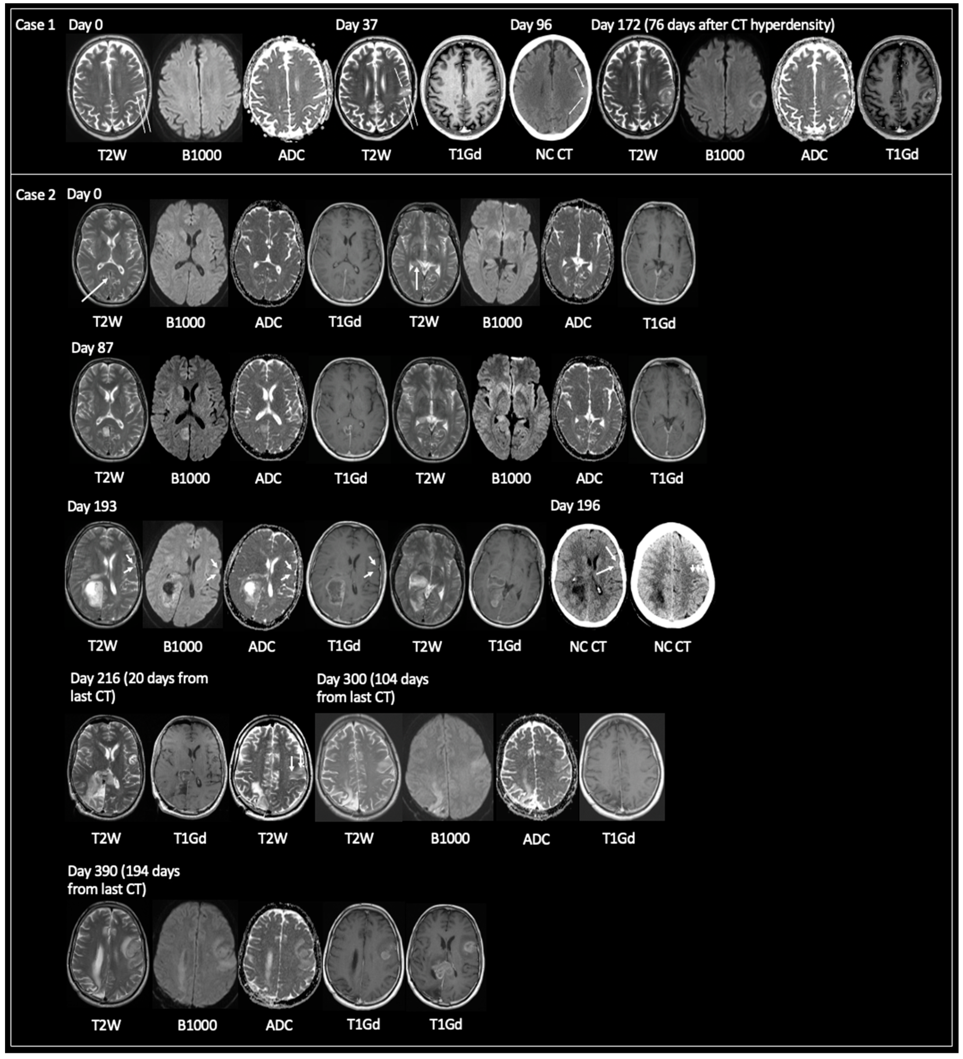 Curroncol 30 00490 g004 Curroncol 30 00490 g004