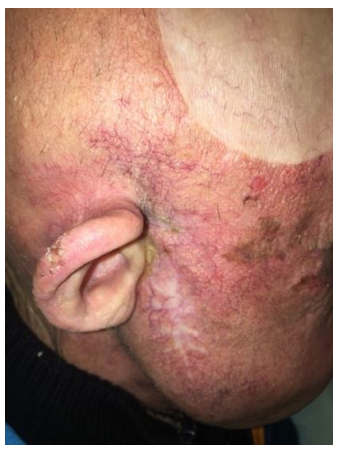 Curroncol 30 00491 g002 Curroncol 30 00491 g002