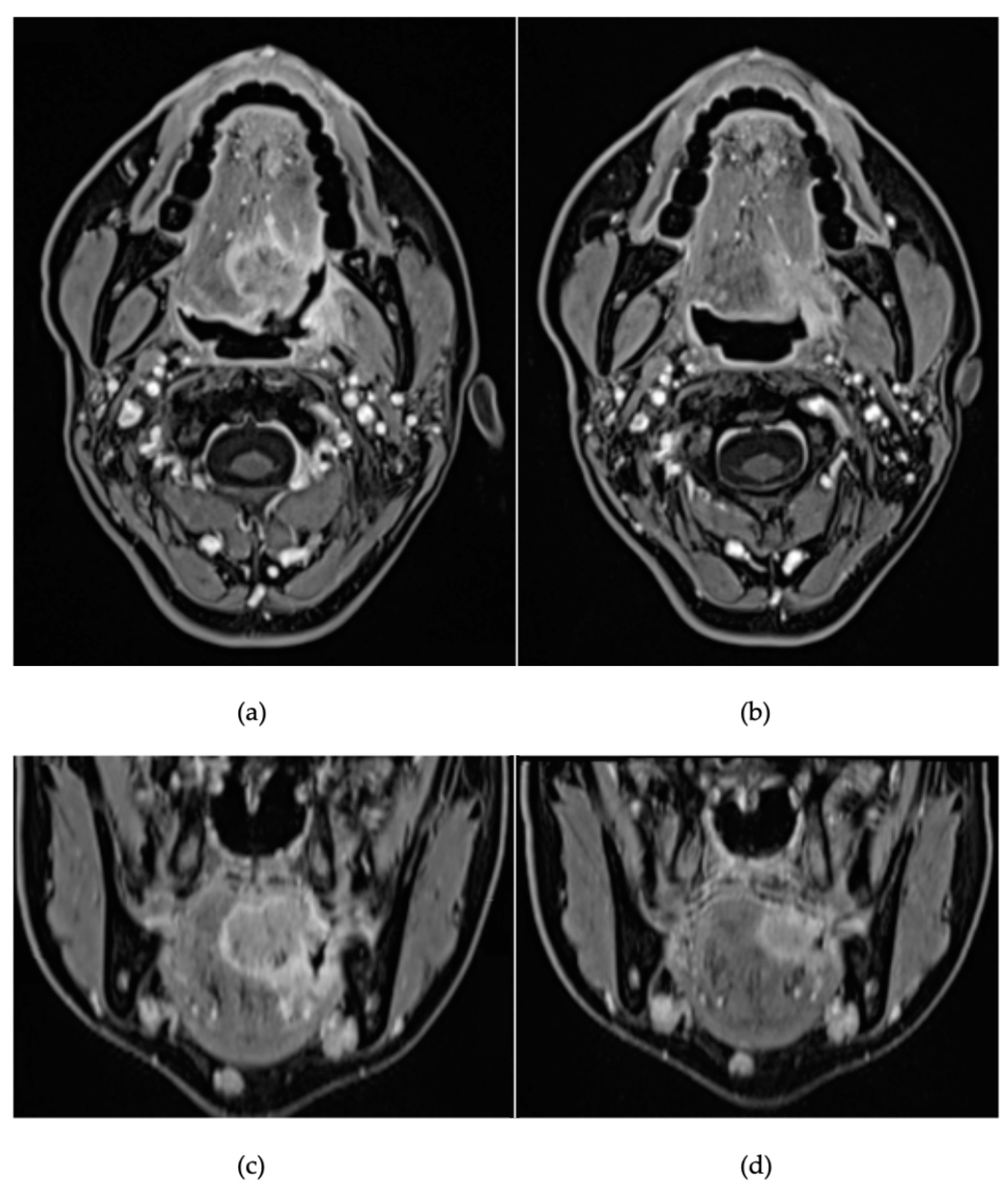Curroncol 30 00492 g002 Curroncol 30 00492 g002