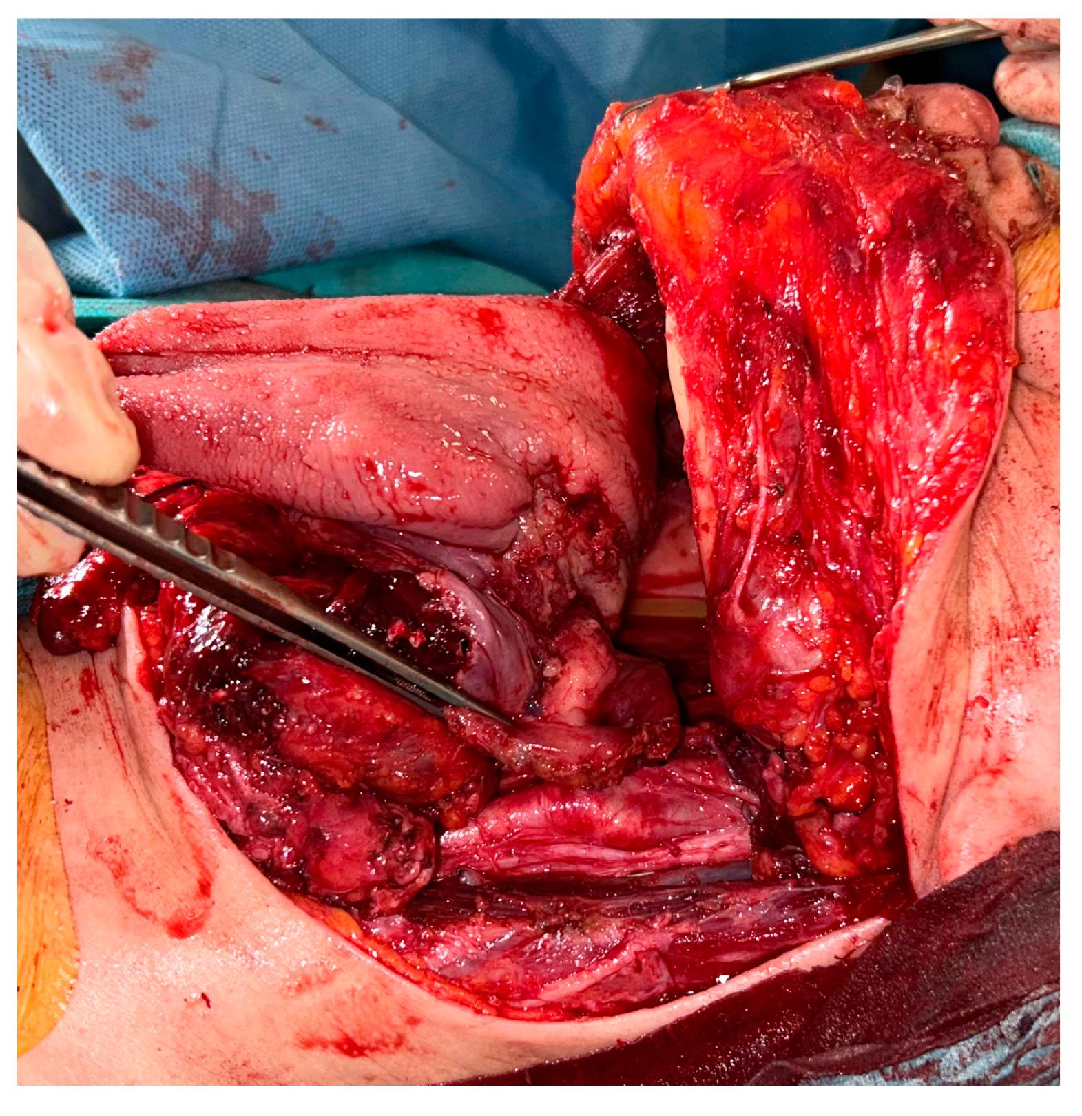 Curroncol 30 00492 g003 Curroncol 30 00492 g003