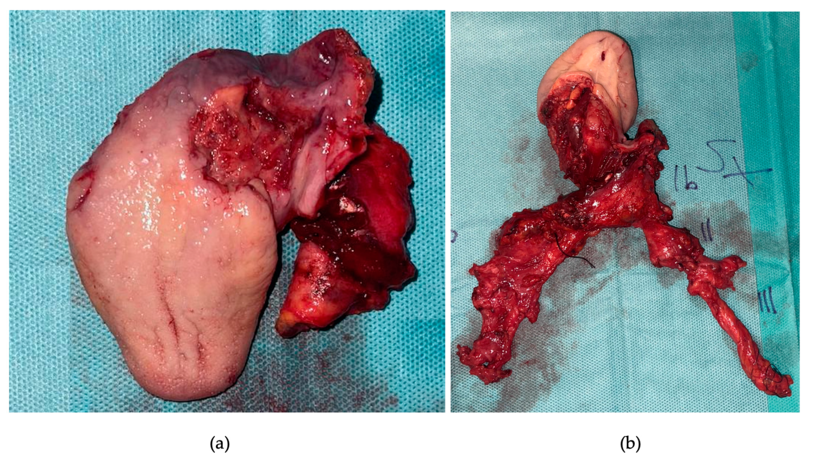 Curroncol 30 00492 g004 Curroncol 30 00492 g004