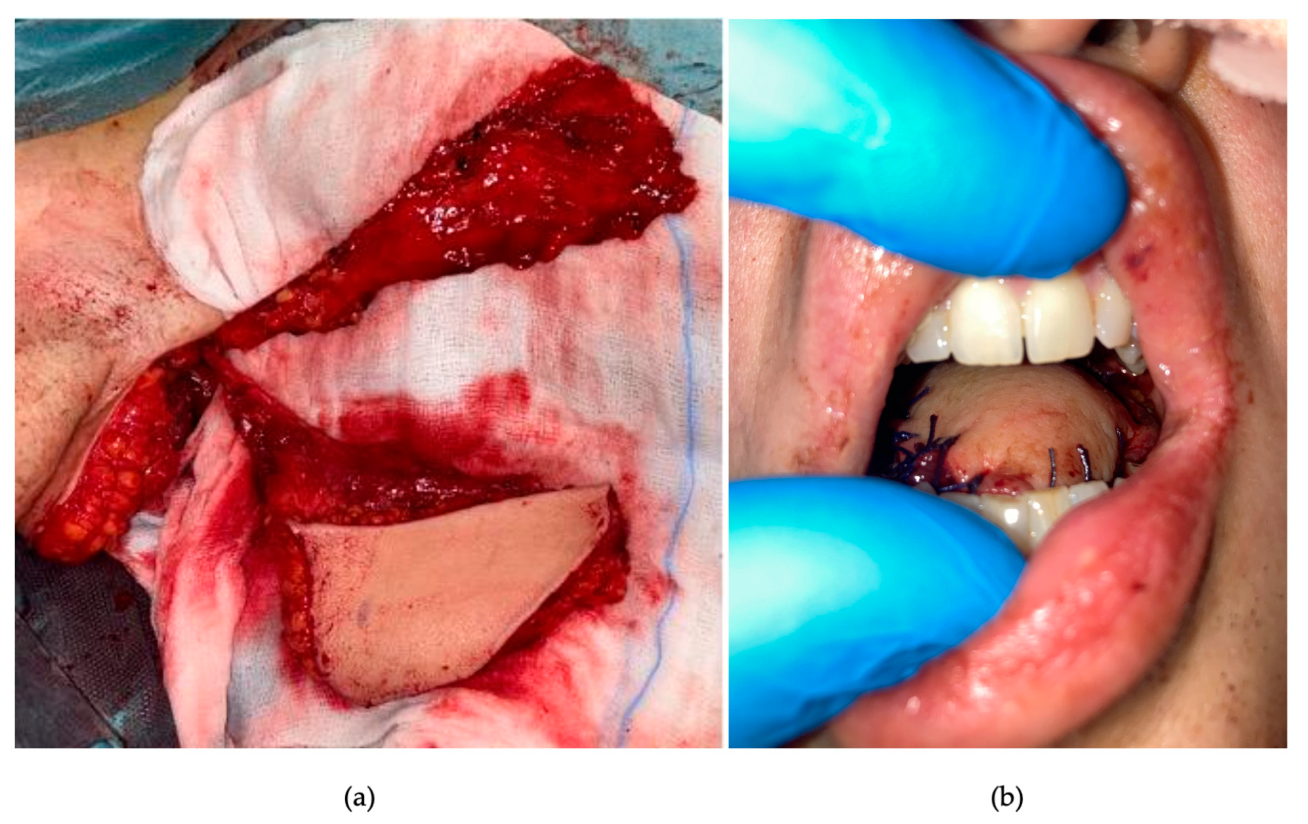 Curroncol 30 00492 g005 Curroncol 30 00492 g005