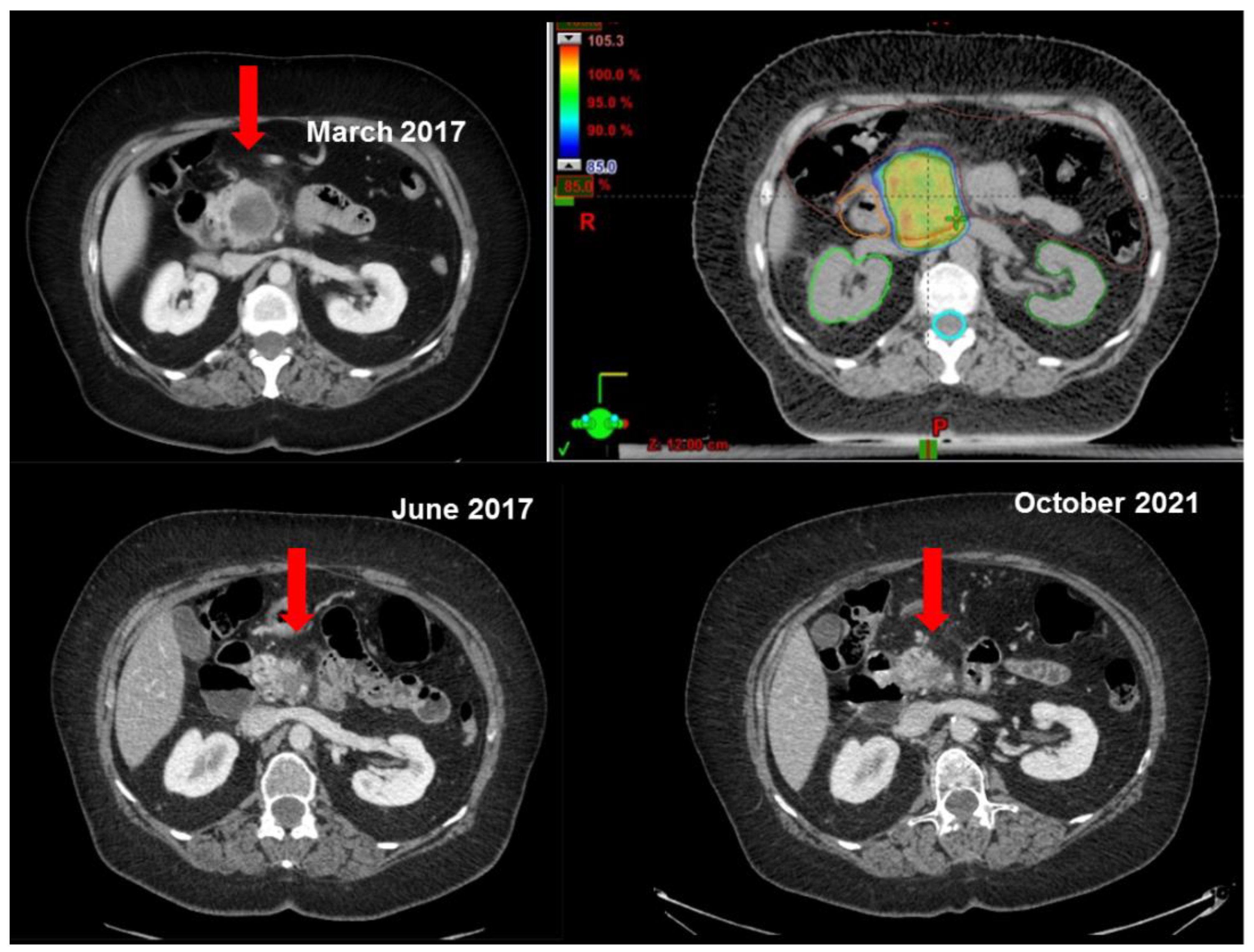 Curroncol 30 00513 g002 Curroncol 30 00513 g002