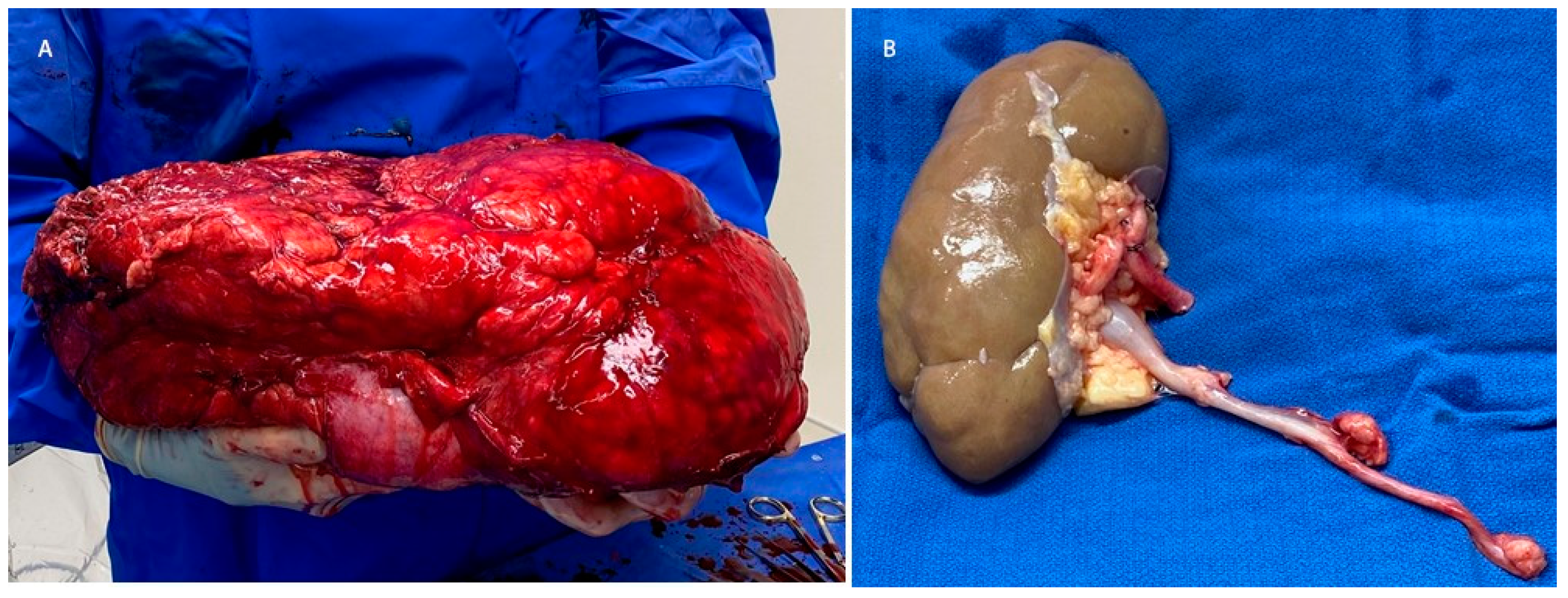 Curroncol 30 00552 g002 Curroncol 30 00552 g002