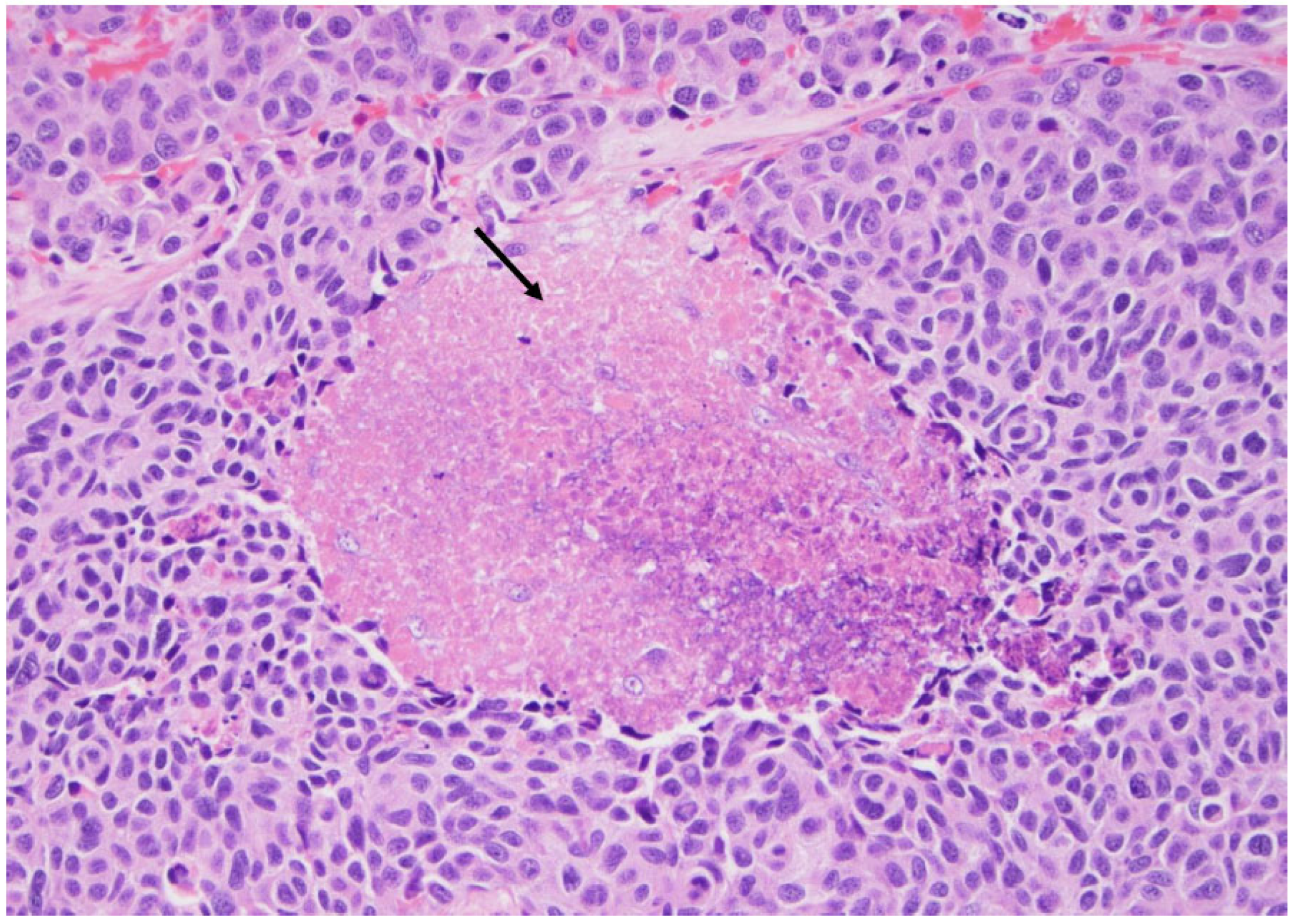 Curroncol 30 00562 g011