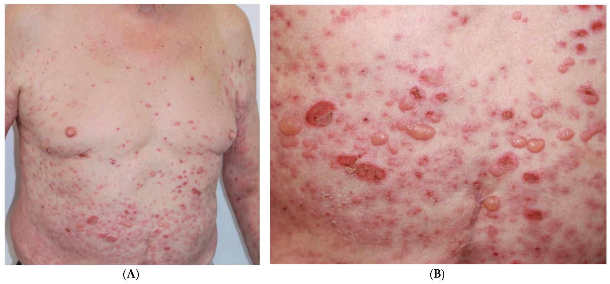 Curroncol 30 00566 g001