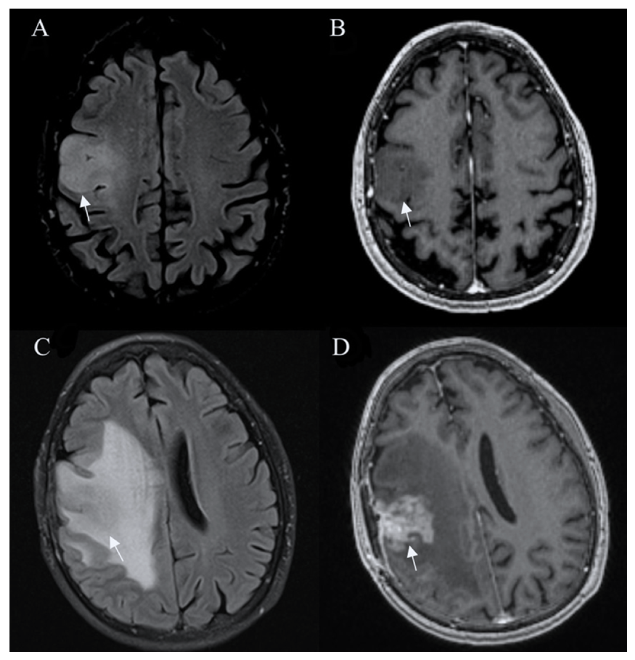 Curroncol 30 00568 g001 Curroncol 30 00568 g001