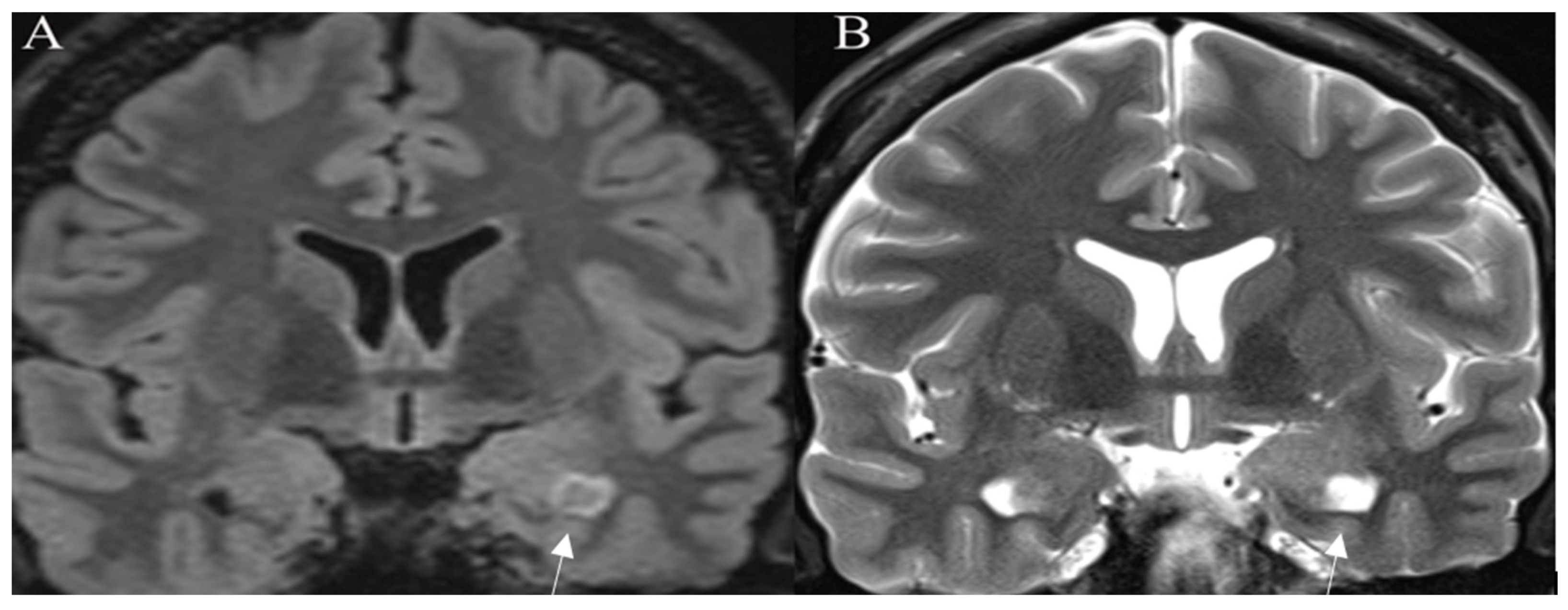 Curroncol 30 00568 g002 Curroncol 30 00568 g002