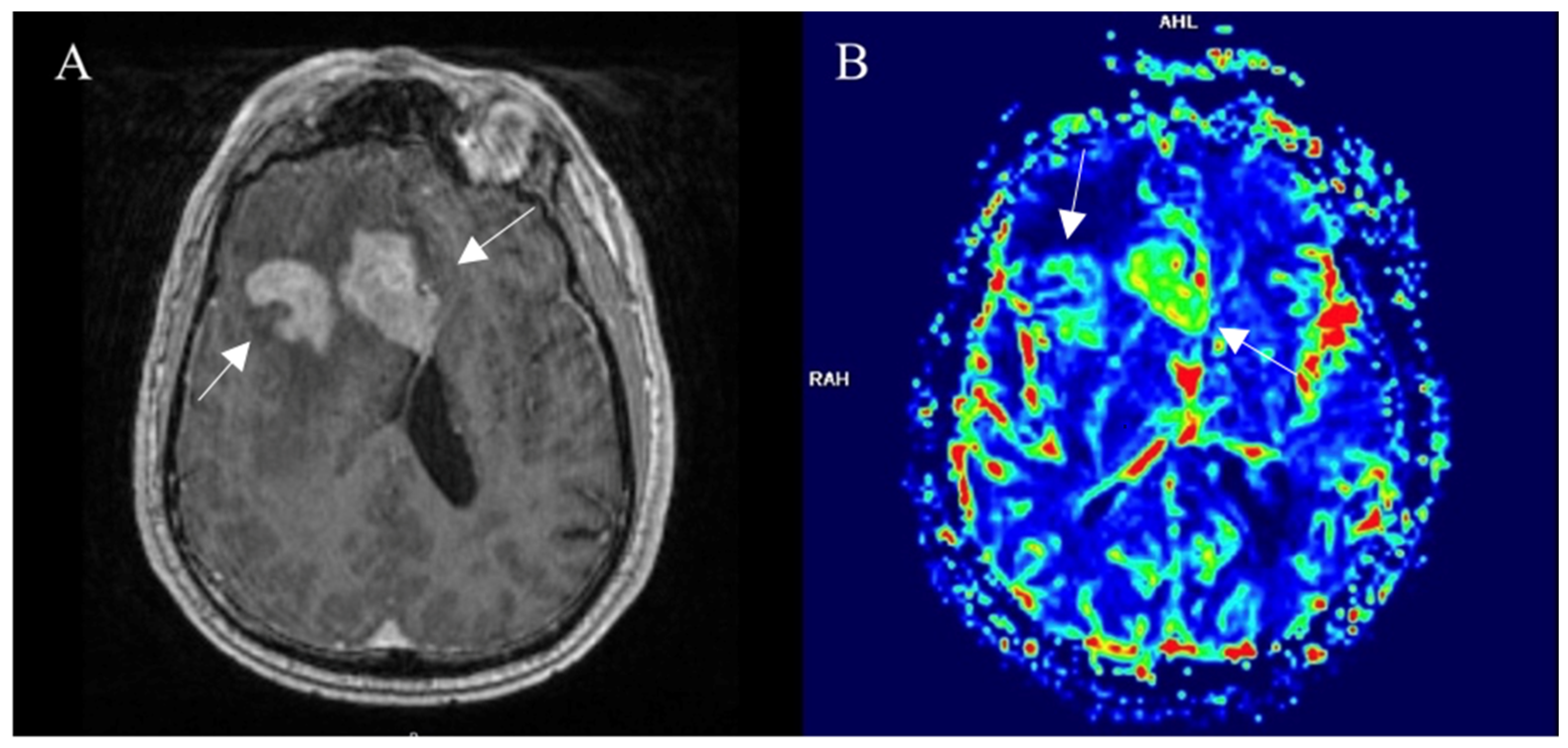 Curroncol 30 00568 g003 Curroncol 30 00568 g003