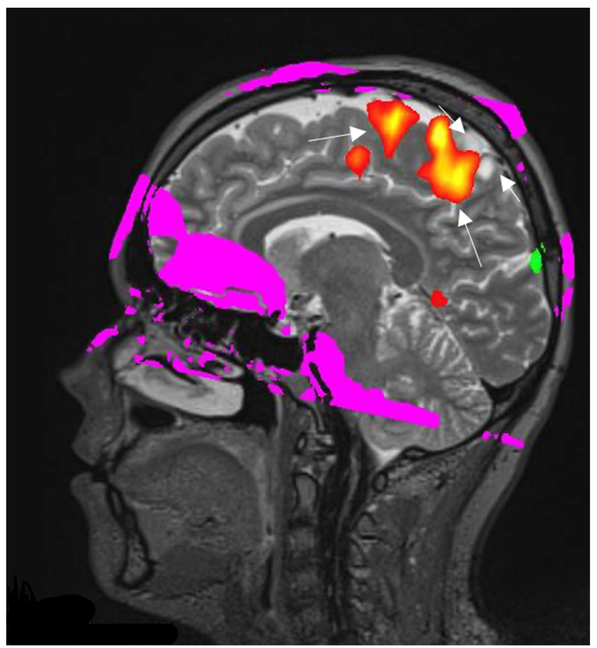 Curroncol 30 00568 g005 Curroncol 30 00568 g005