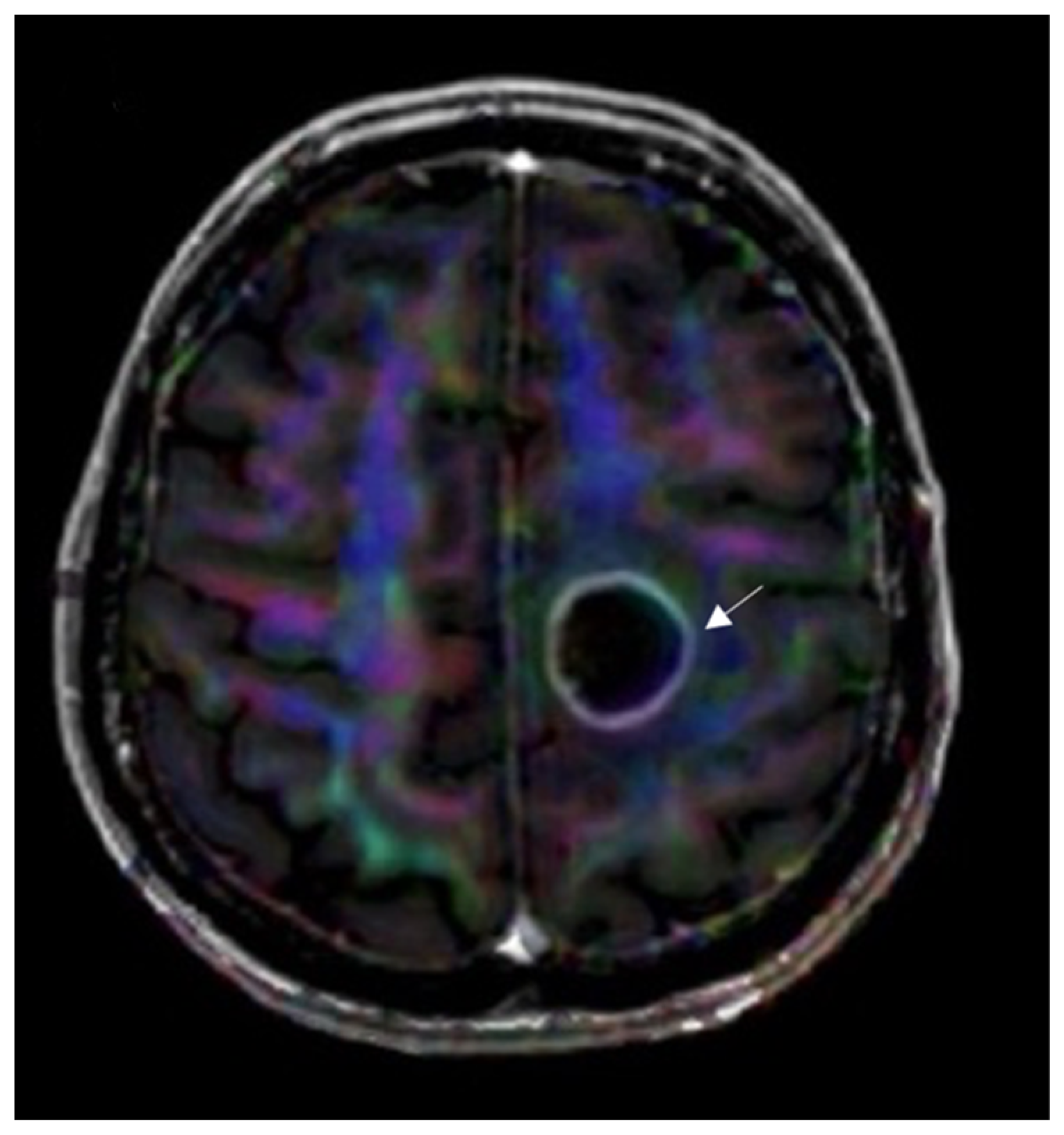 Curroncol 30 00568 g006 Curroncol 30 00568 g006