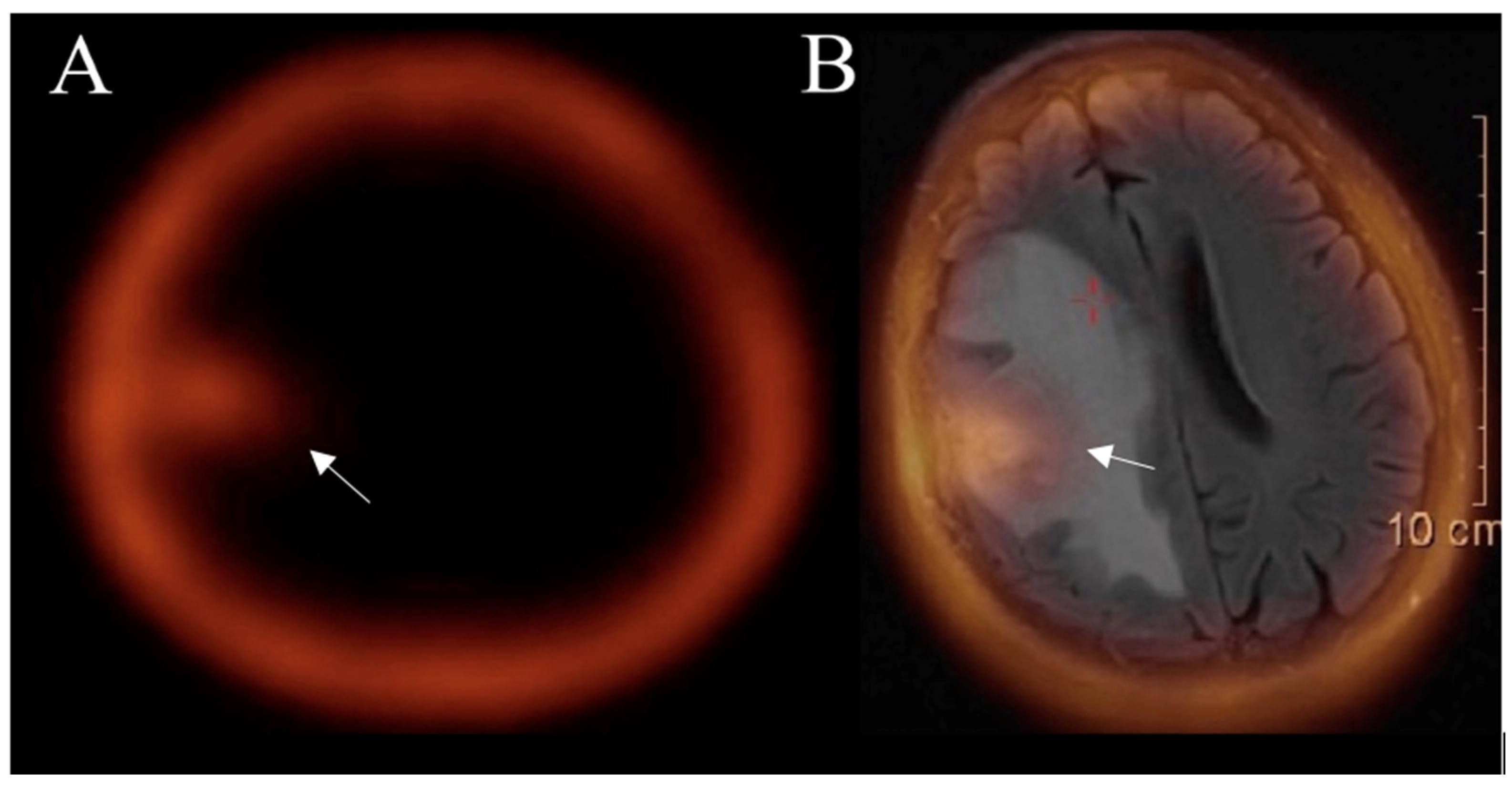 Curroncol 30 00568 g007 Curroncol 30 00568 g007