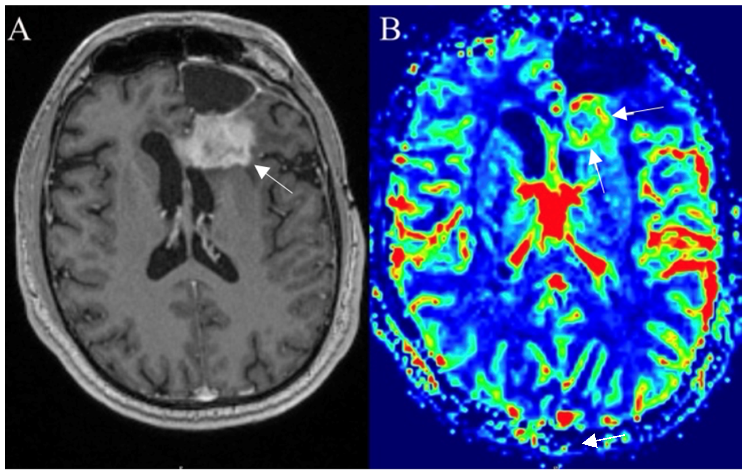 Curroncol 30 00568 g008 Curroncol 30 00568 g008