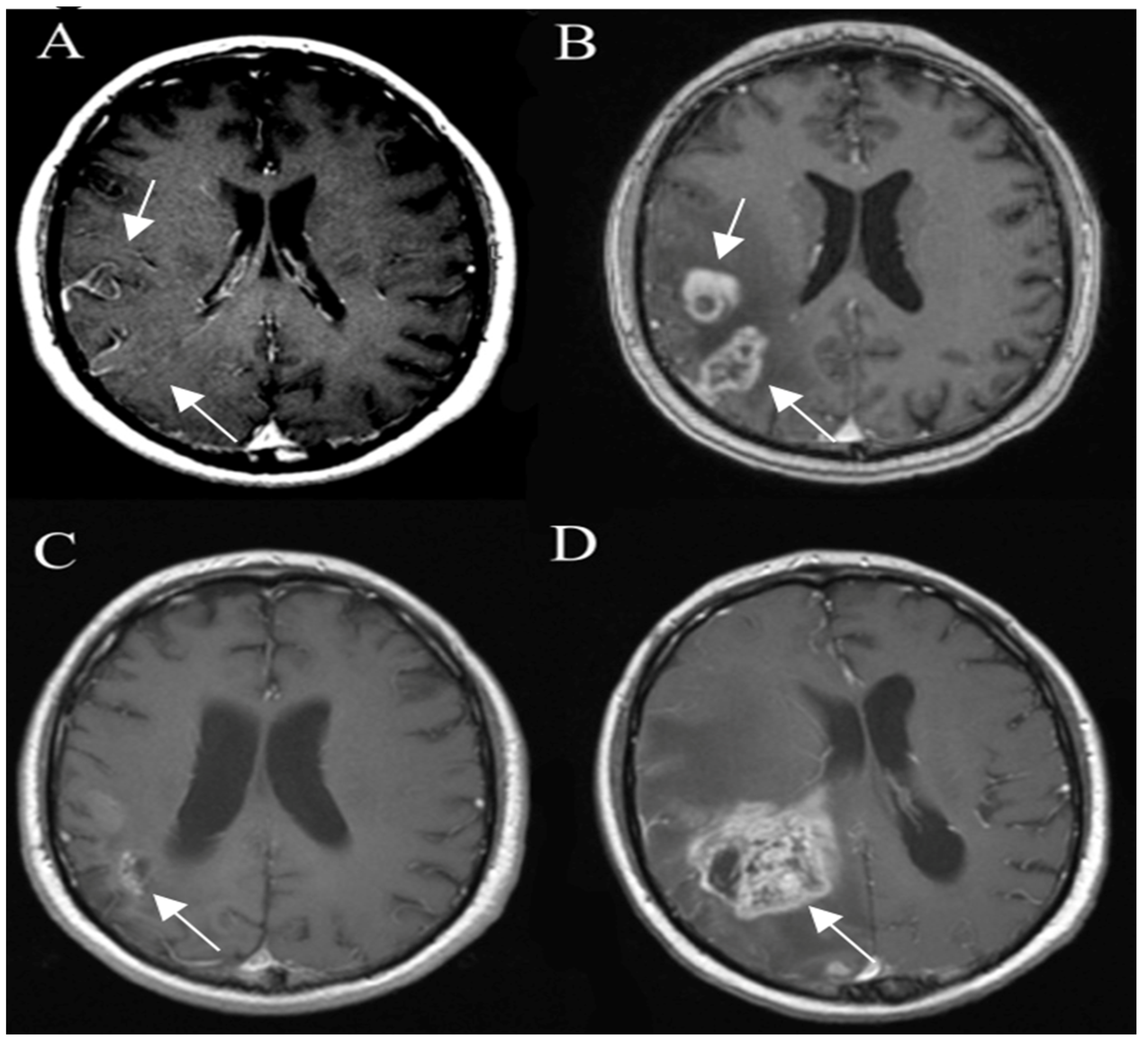 Curroncol 30 00568 g009 Curroncol 30 00568 g009
