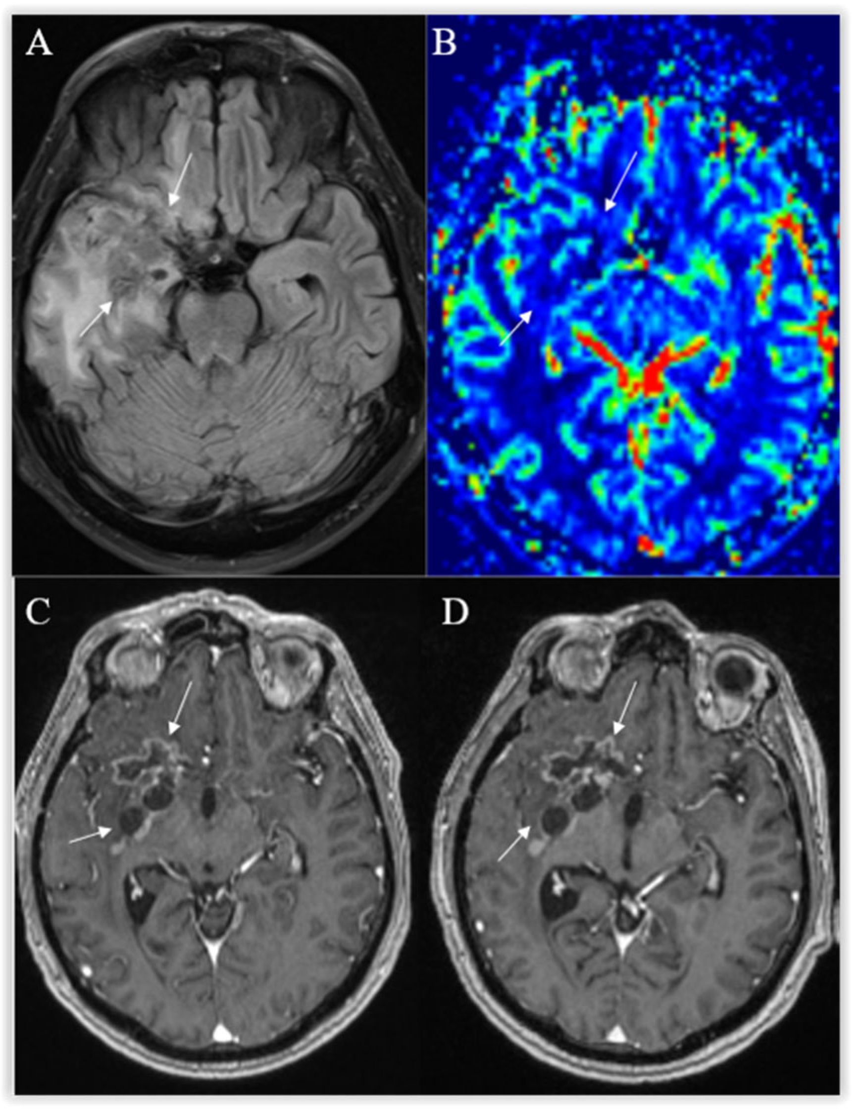 Curroncol 30 00568 g010 Curroncol 30 00568 g010