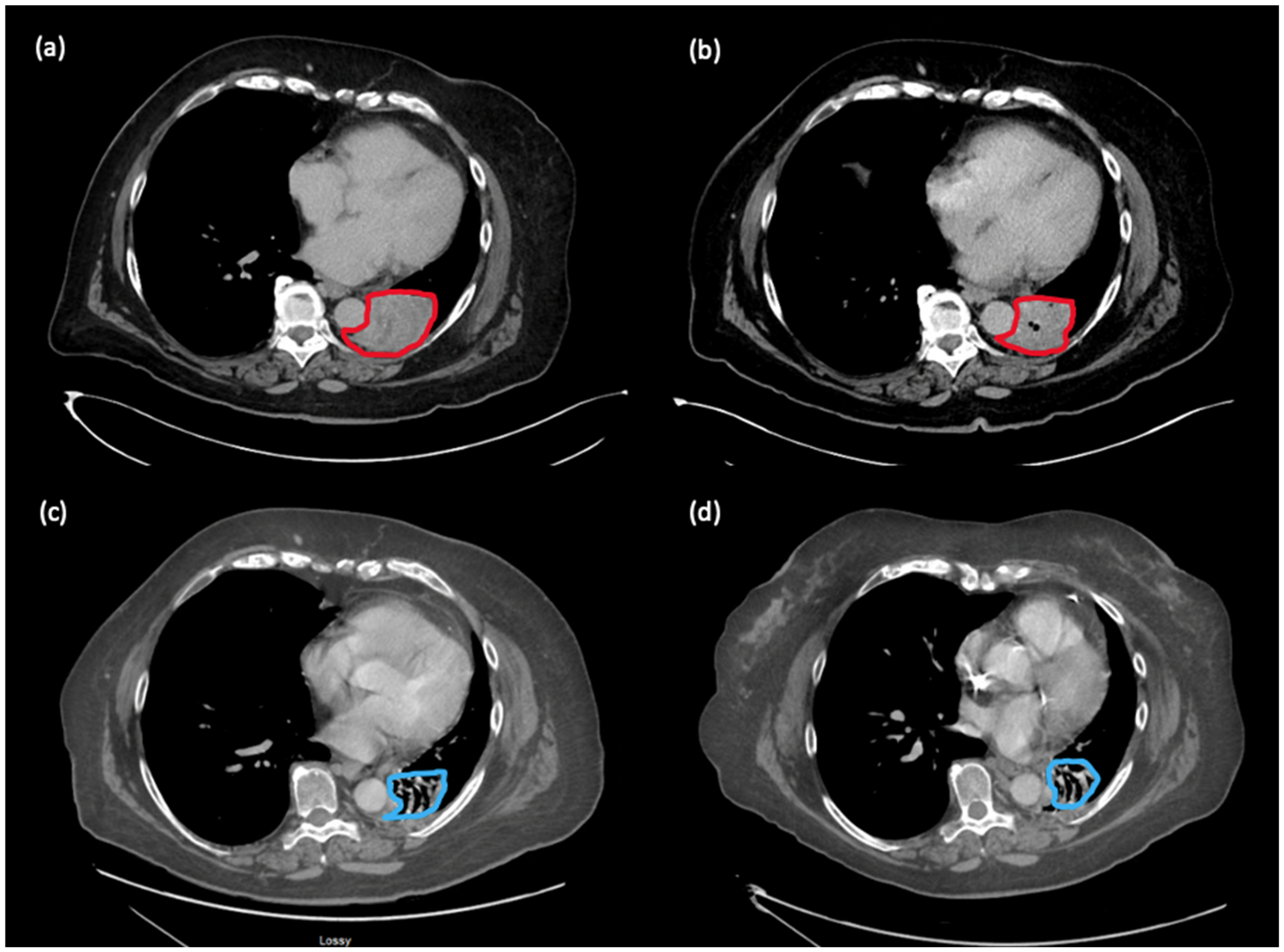 Curroncol 30 00570 g002