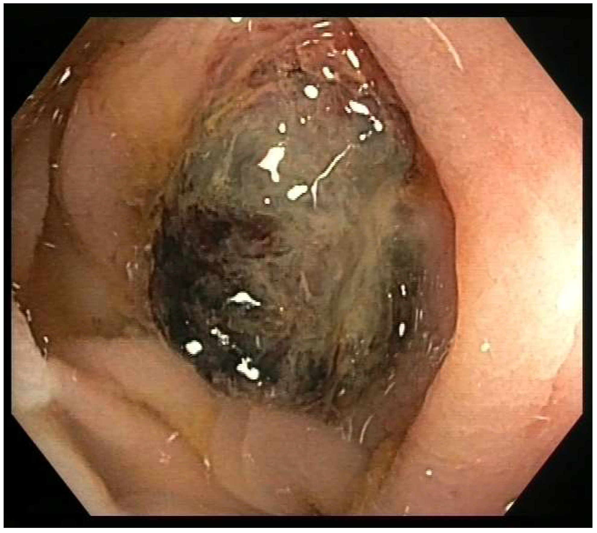 Curroncol 30 00613 g001