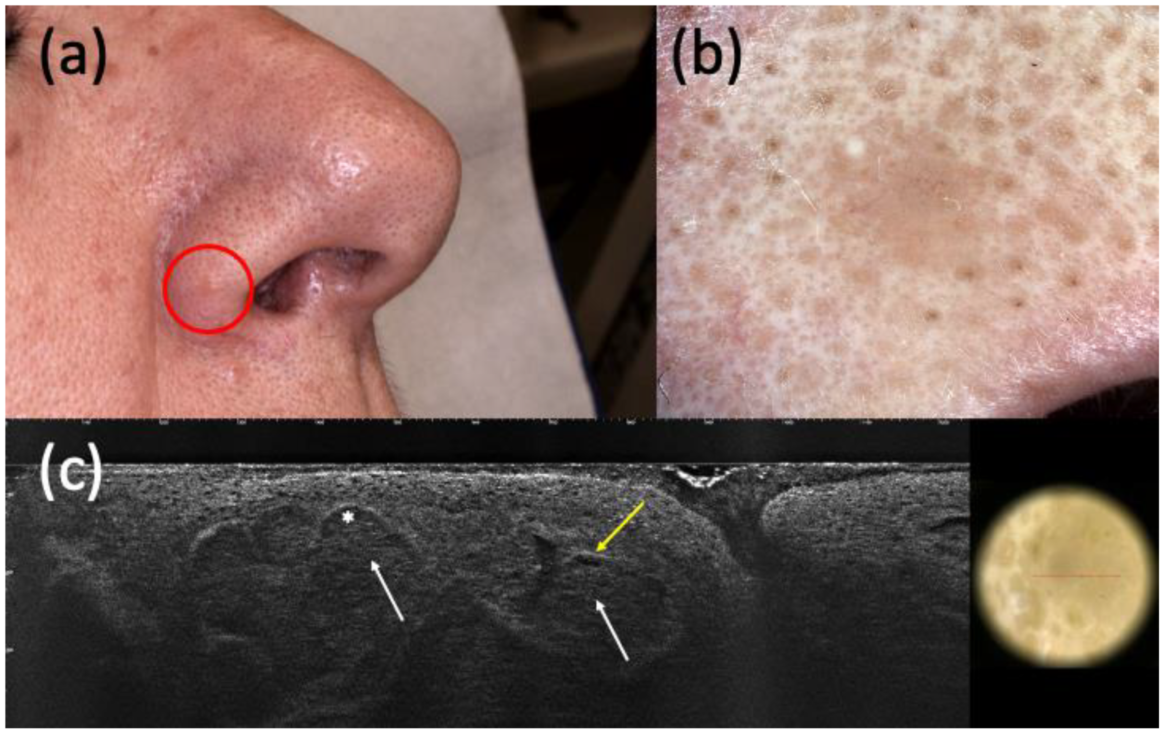 Curroncol 30 00639 g001