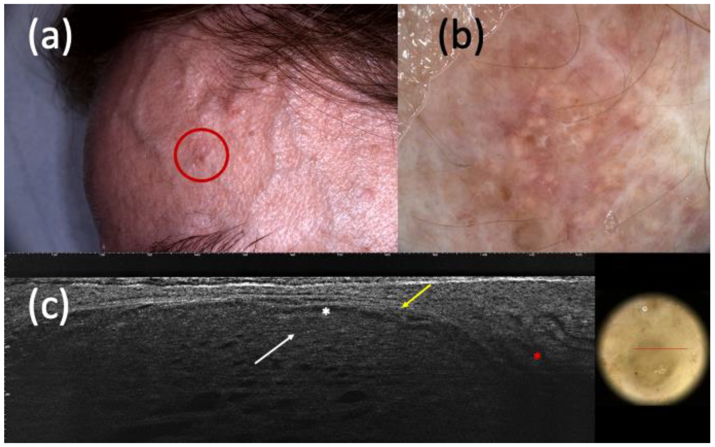 Curroncol 30 00639 g004