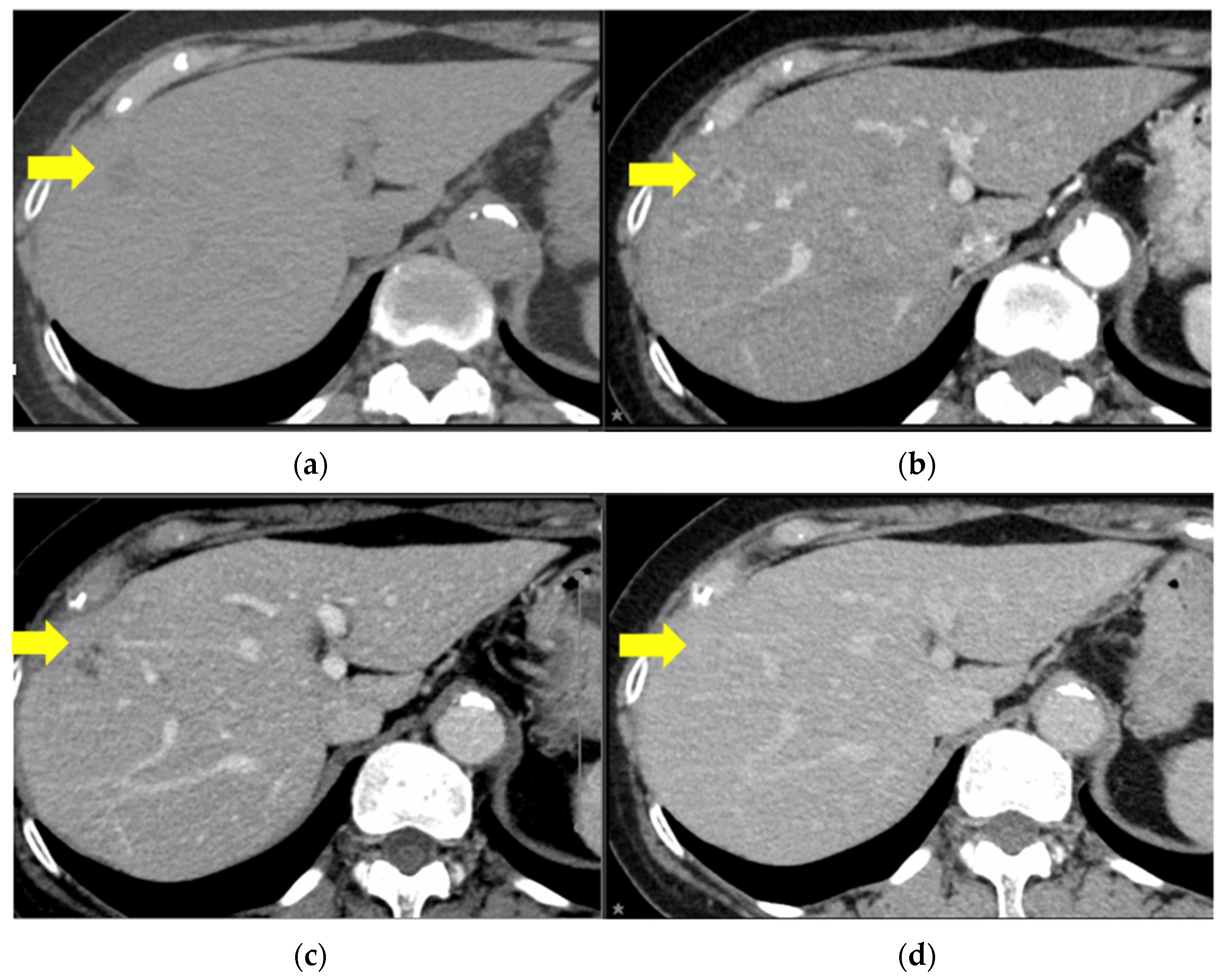 Curroncol 31 00013 g002
