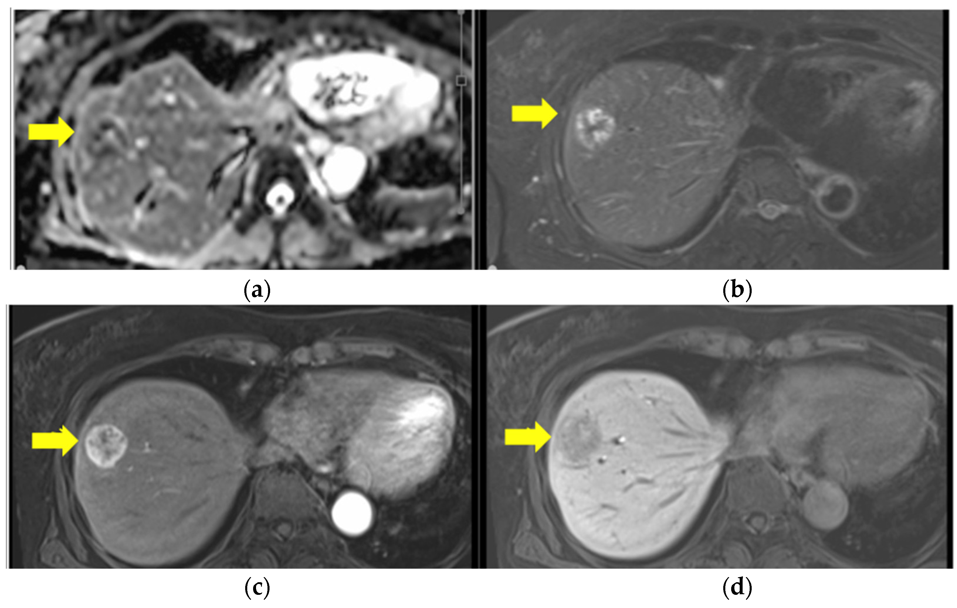 Curroncol 31 00013 g003