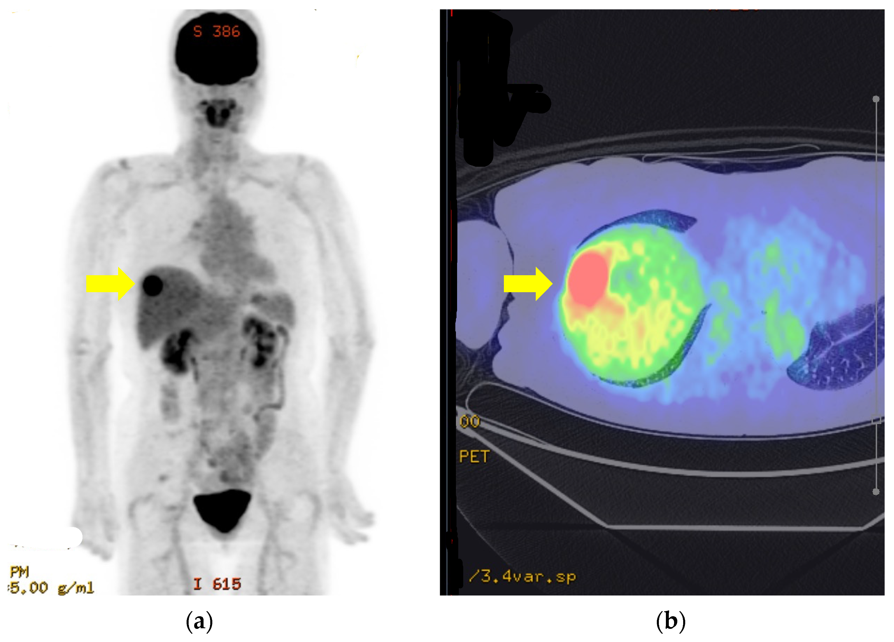 Curroncol 31 00013 g004