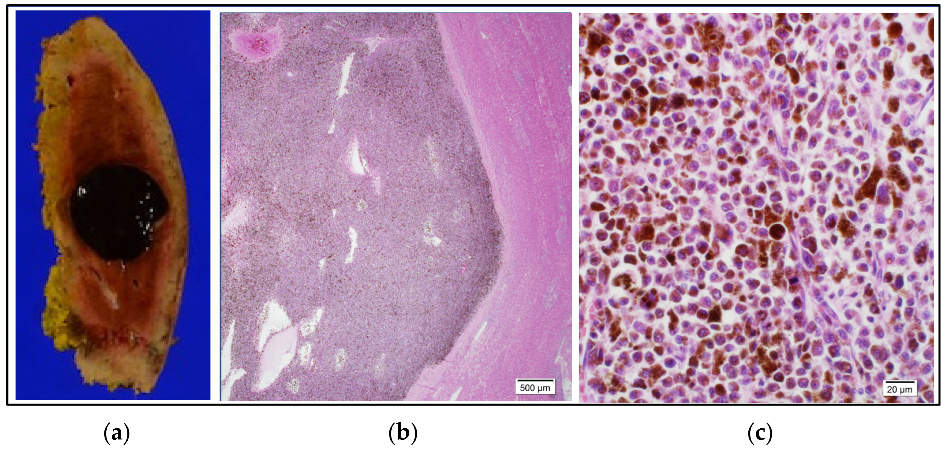 Curroncol 31 00013 g006