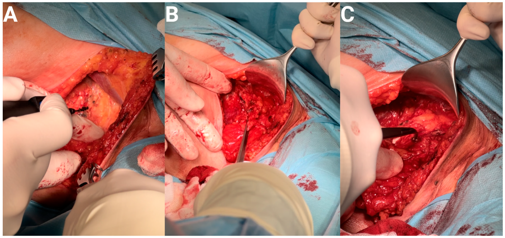 Curroncol 31 00020 g003