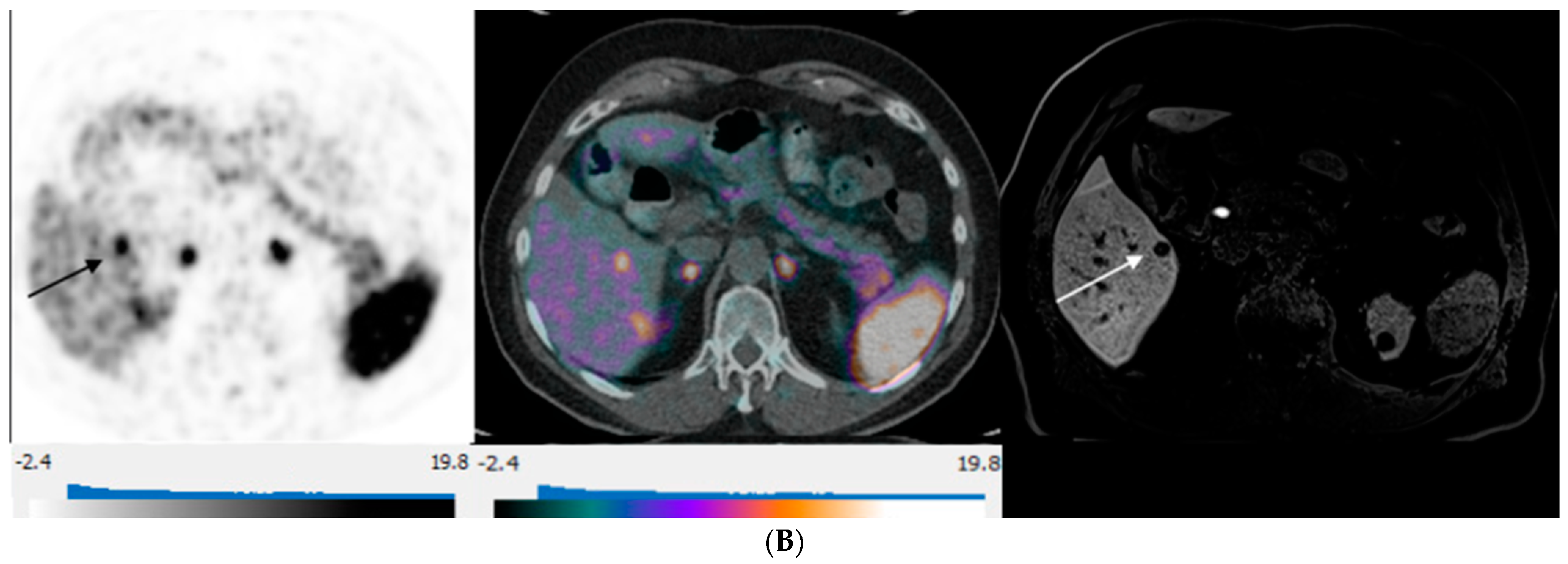 Curroncol 31 00036 g003b
