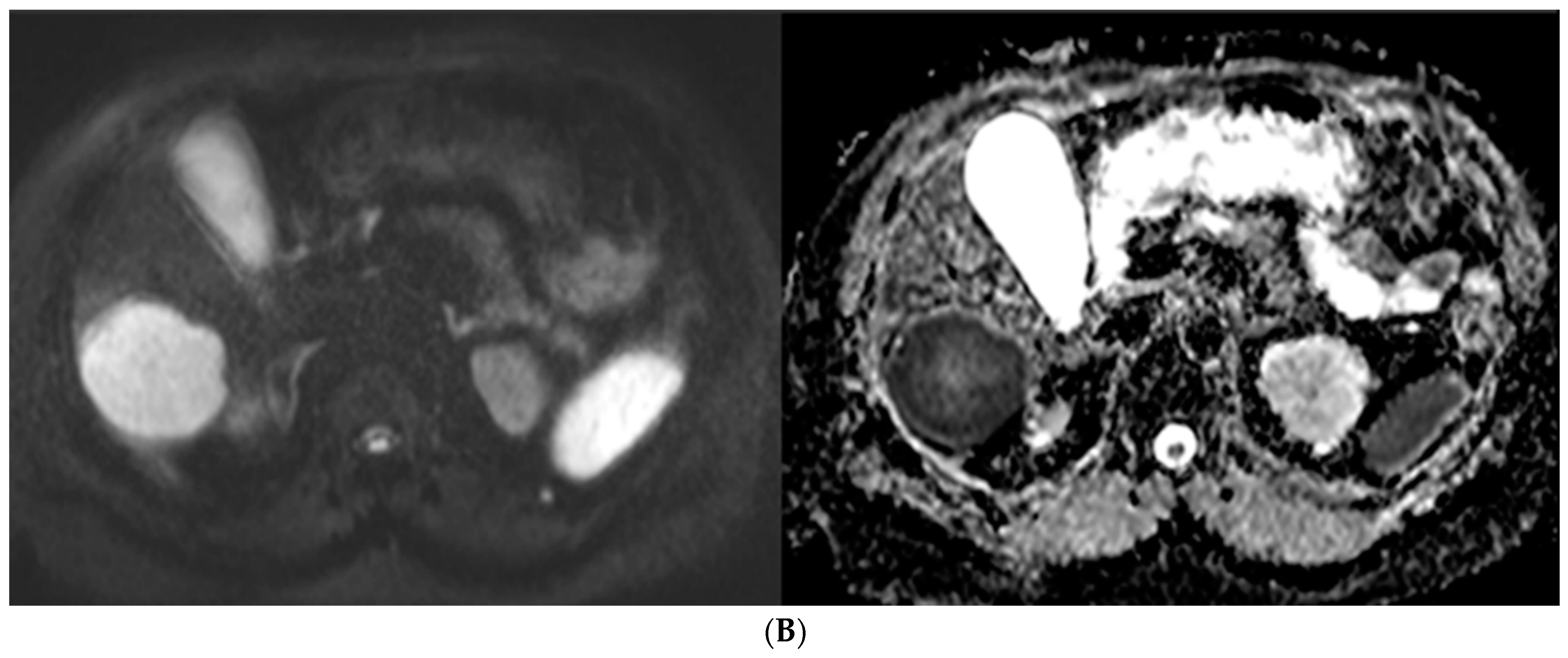 Curroncol 31 00036 g005b