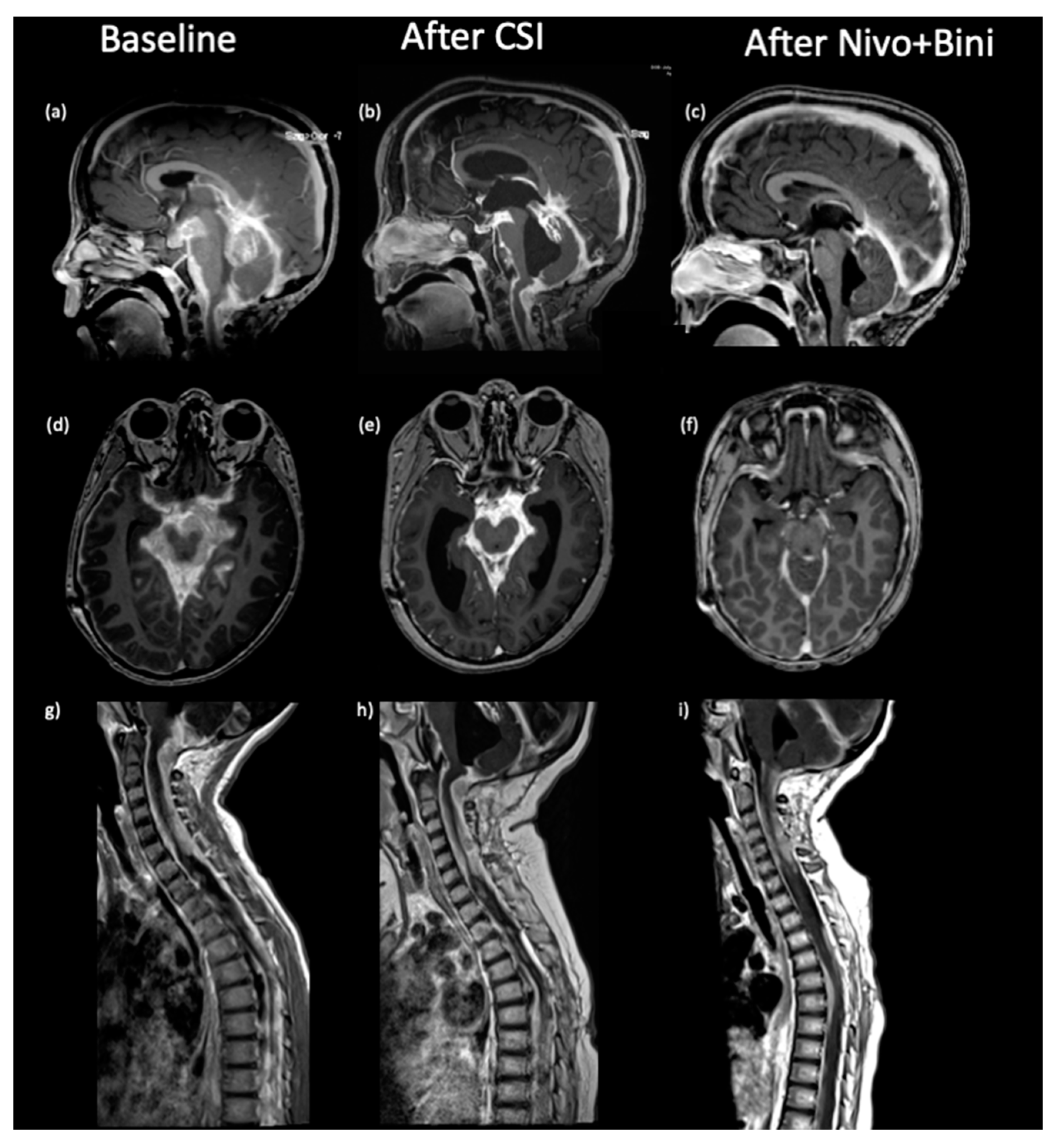 Curroncol 31 00041 g001 Curroncol 31 00041 g001